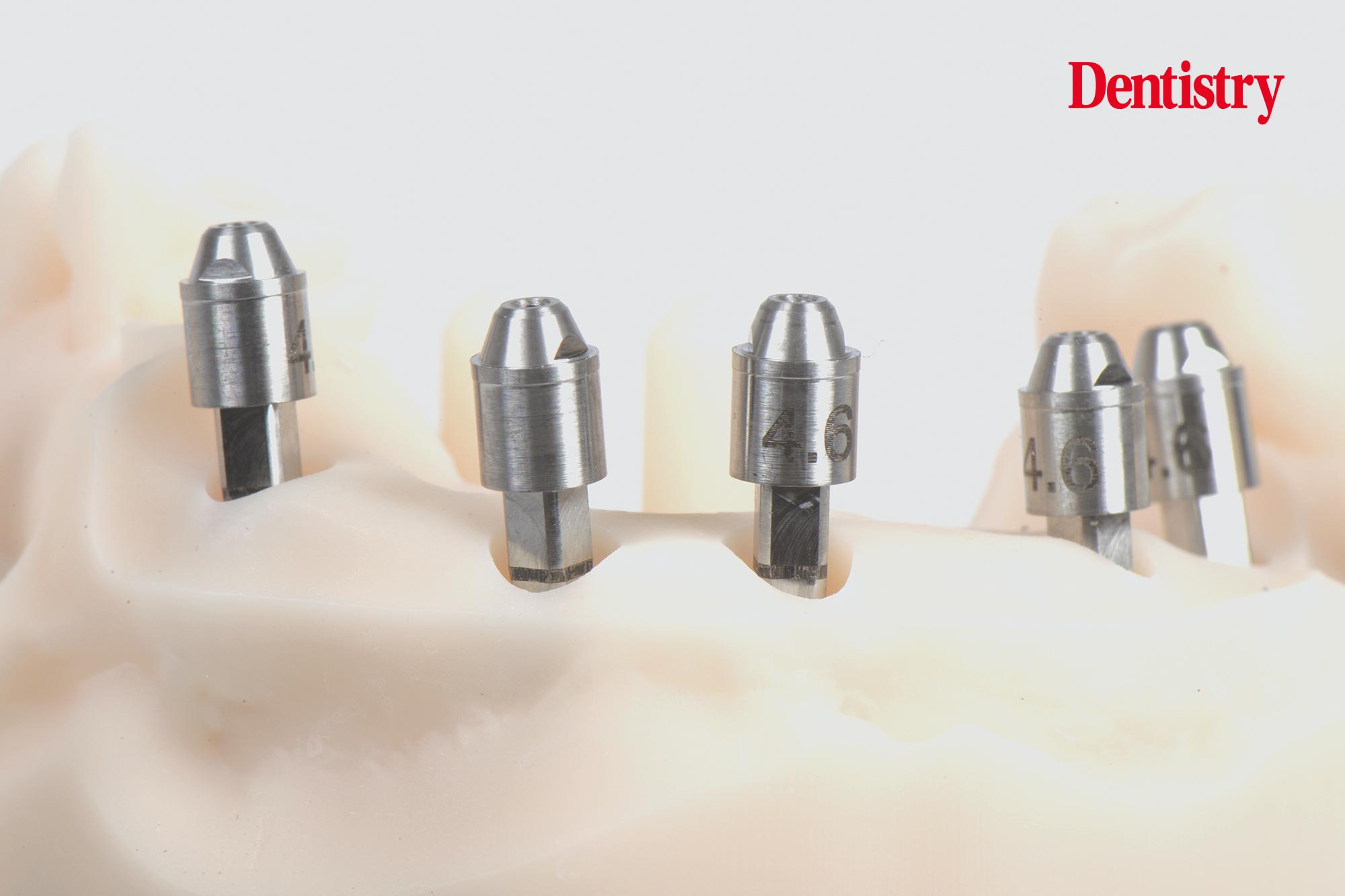 Digital workflow: a game changer for implant restoration
