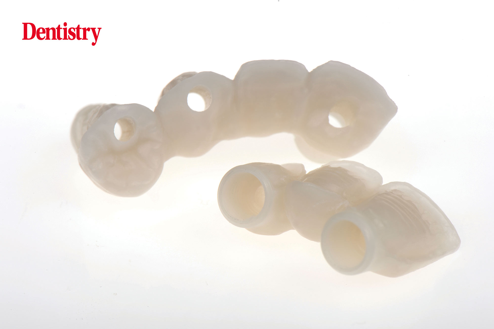 Digital workflow: a game changer for implant restoration