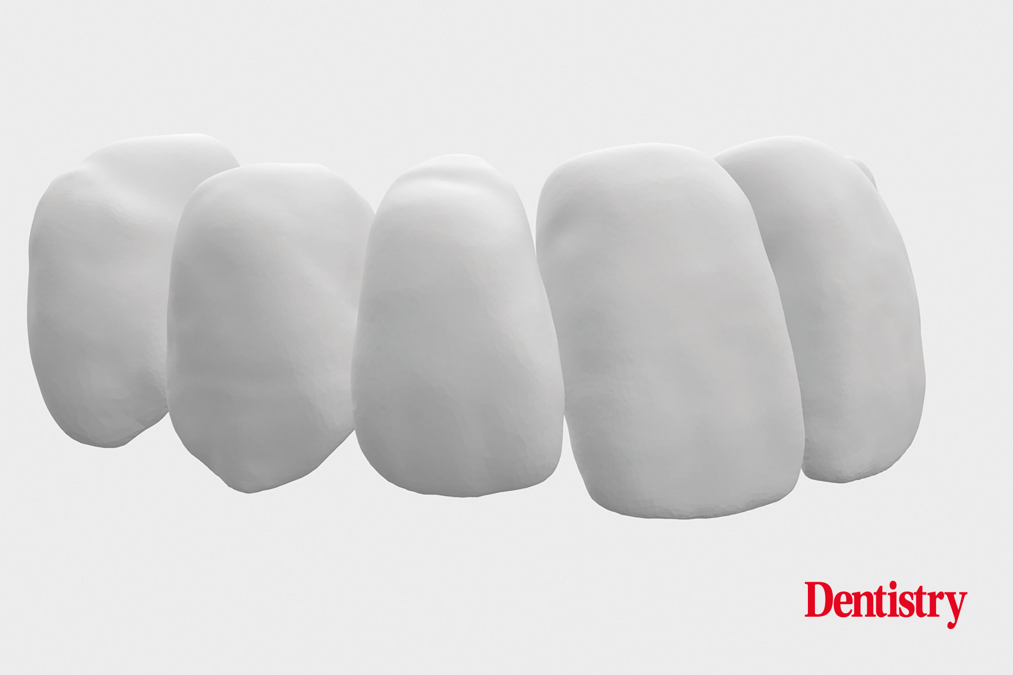 Digital workflow: a game changer for implant restoration