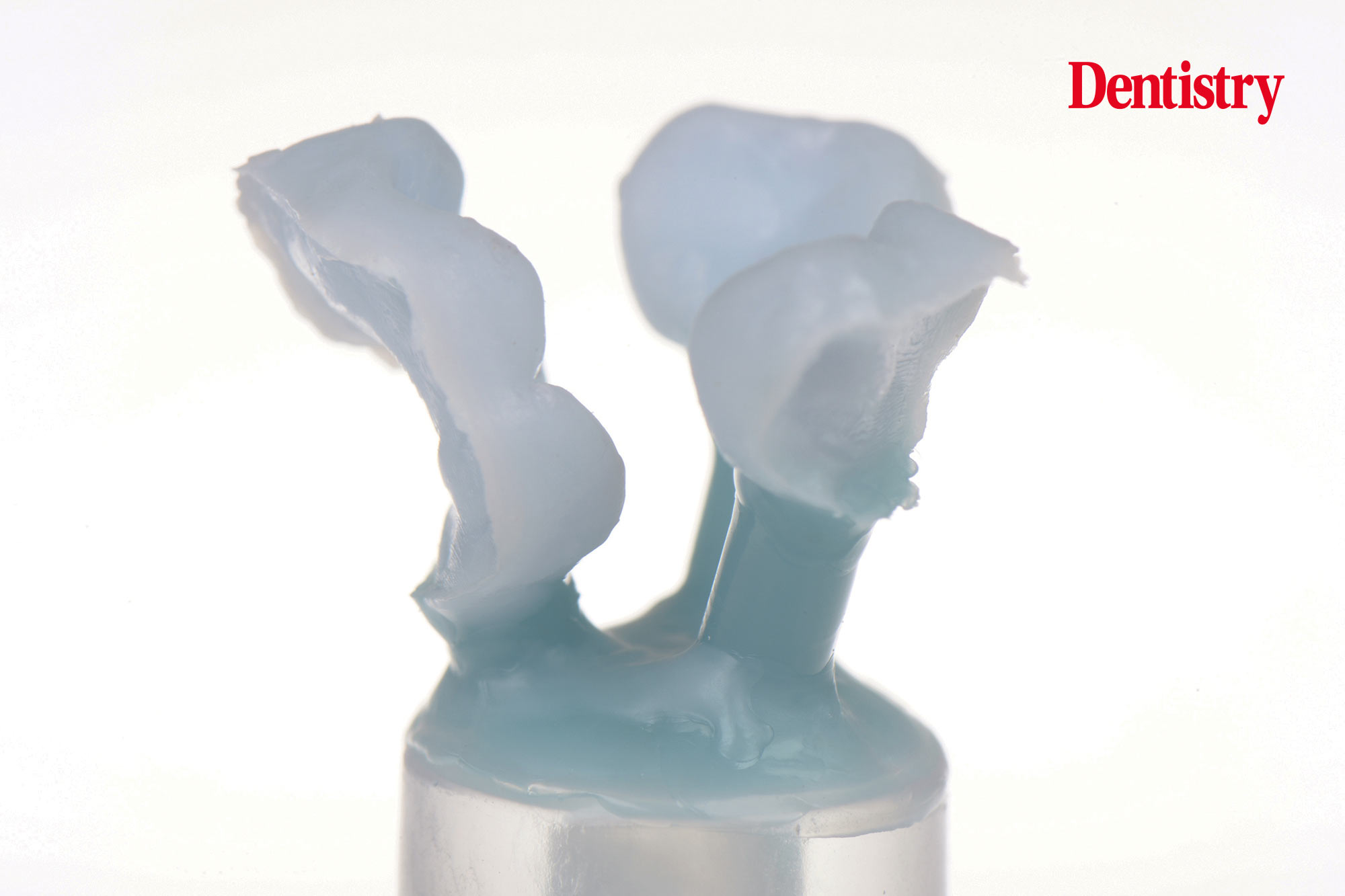 Digital workflow: a game changer for implant restoration – part two
