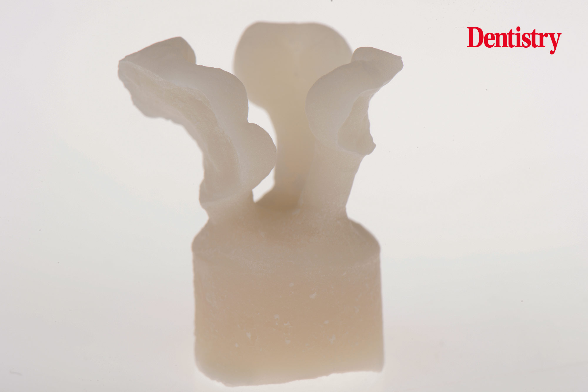 Digital workflow: a game changer for implant restoration – part two