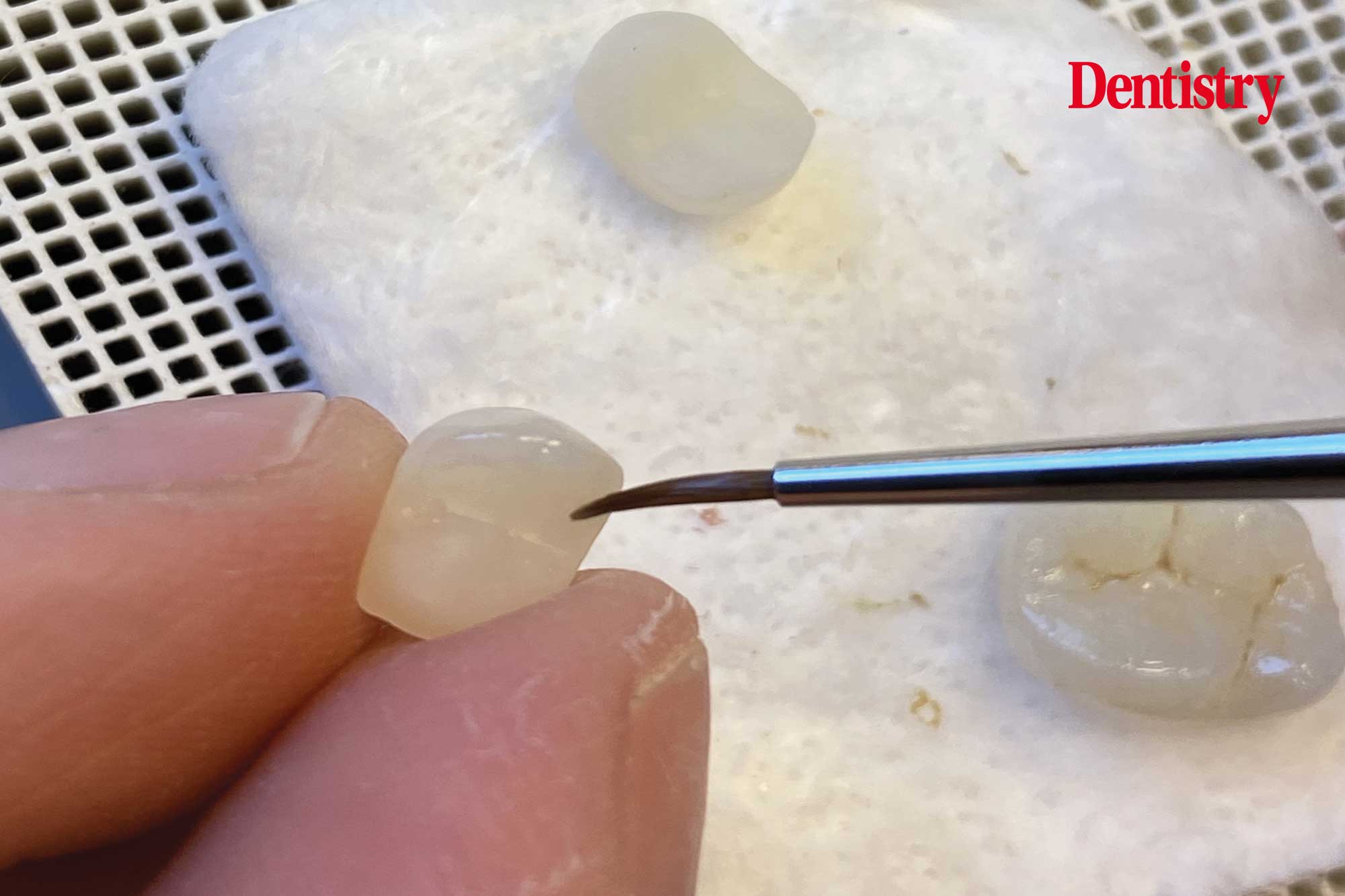 Digital workflow: a game changer for implant restoration – part two
