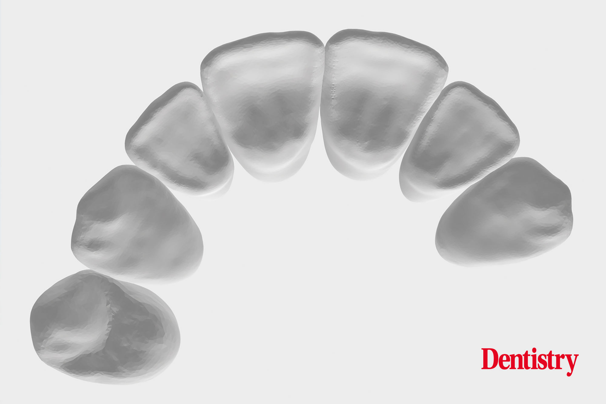 Digital workflow: a game changer for implant restoration