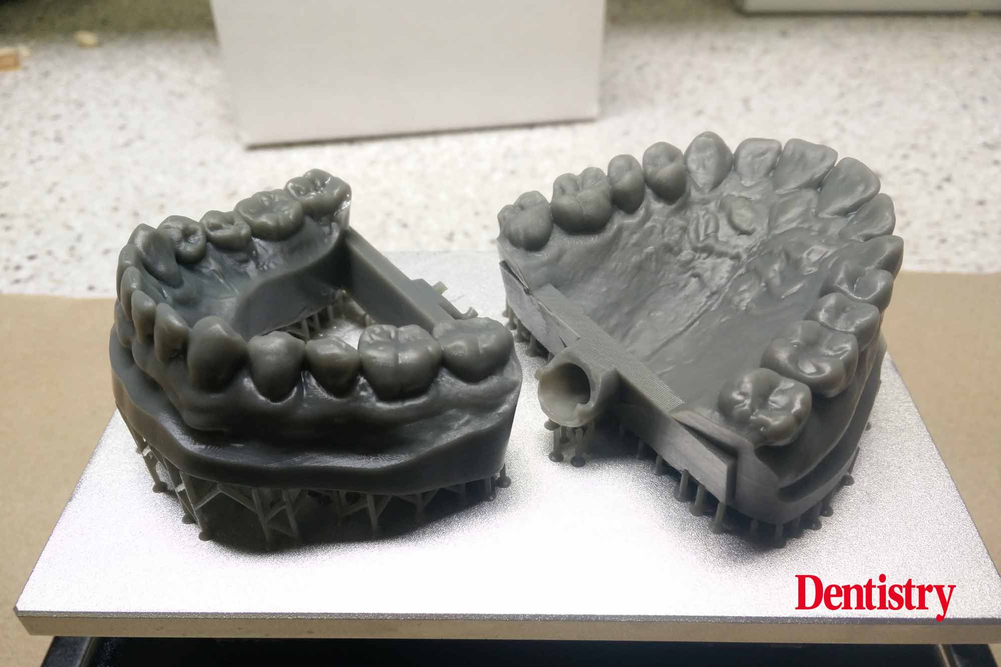 Andre Gaul RDT gives a step-by-step overview of the design and fabrication process of printed occlusal splints.