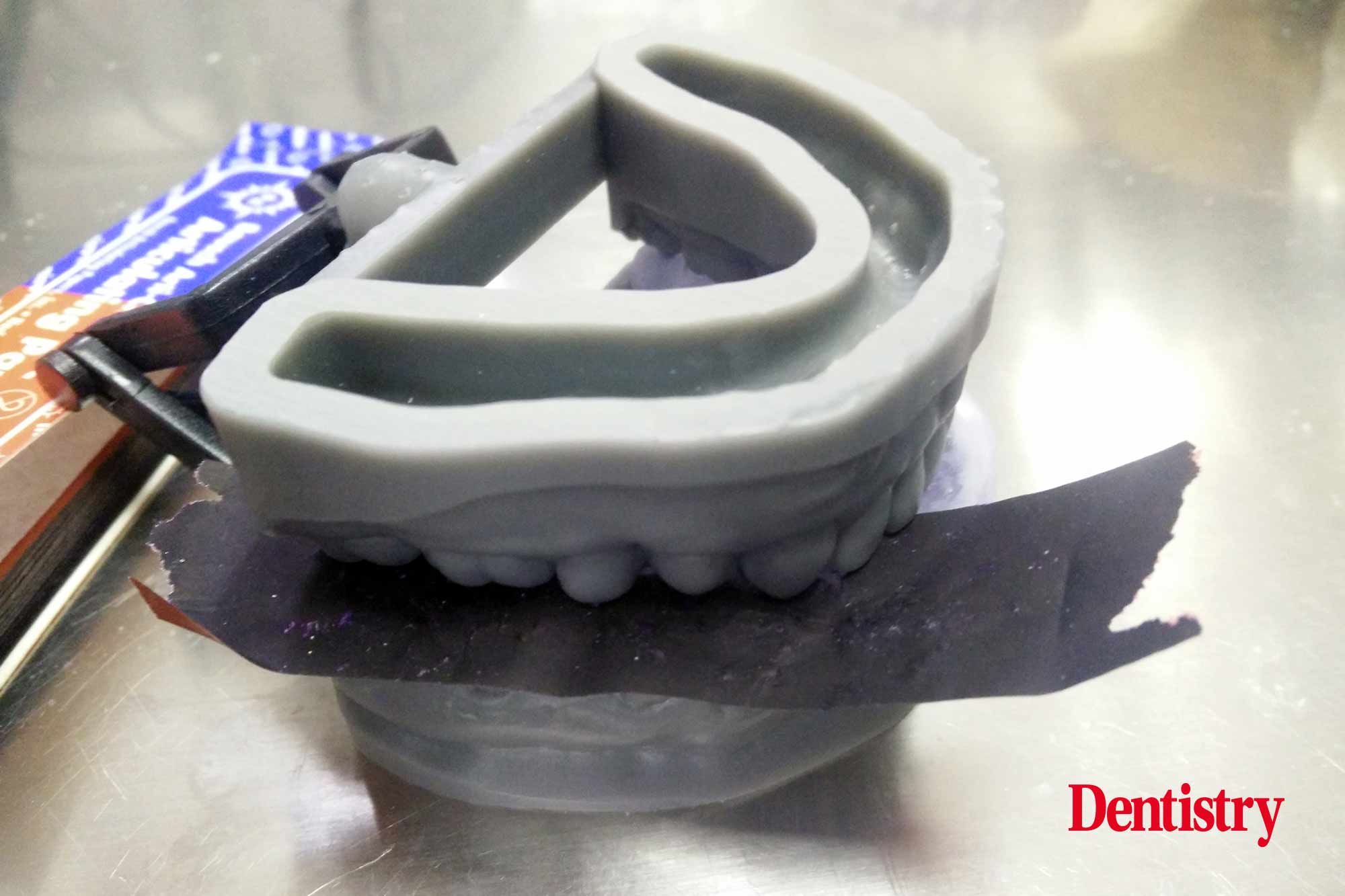Andre Gaul RDT gives a step-by-step overview of the design and fabrication process of printed occlusal splints.