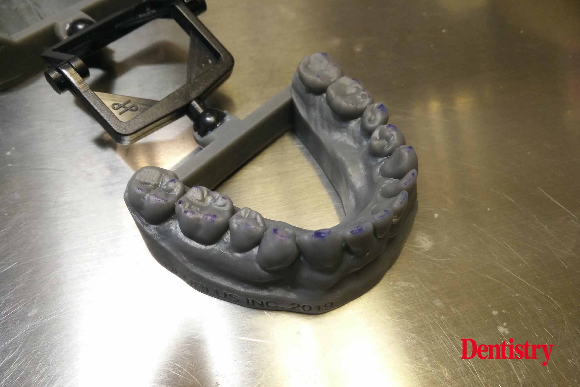 Andre Gaul RDT gives a step-by-step overview of the design and fabrication process of printed occlusal splints.