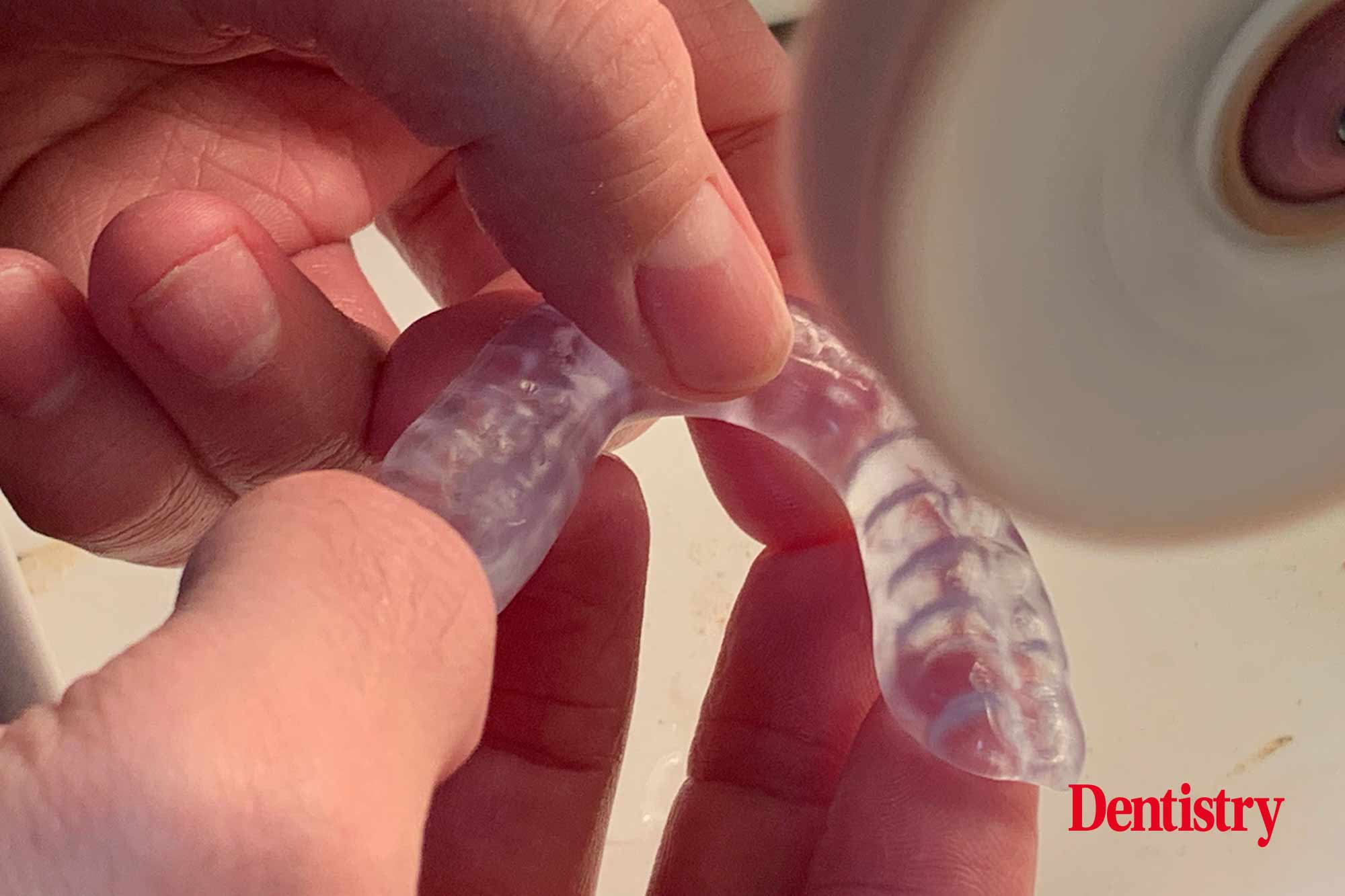 Andre Gaul RDT gives a step-by-step overview of the design and fabrication process of printed occlusal splints.