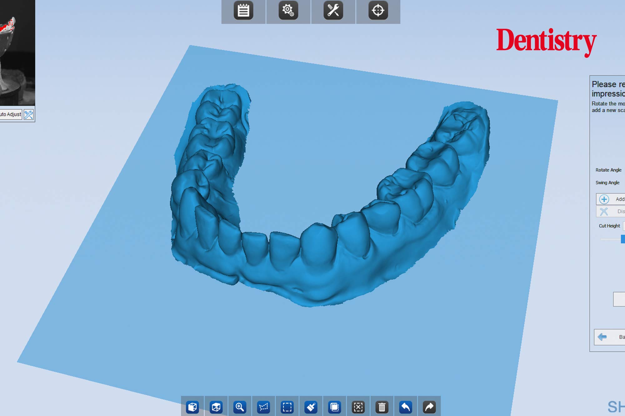 Andre Gaul RDT gives a step-by-step overview of the design and fabrication process of printed occlusal splints.