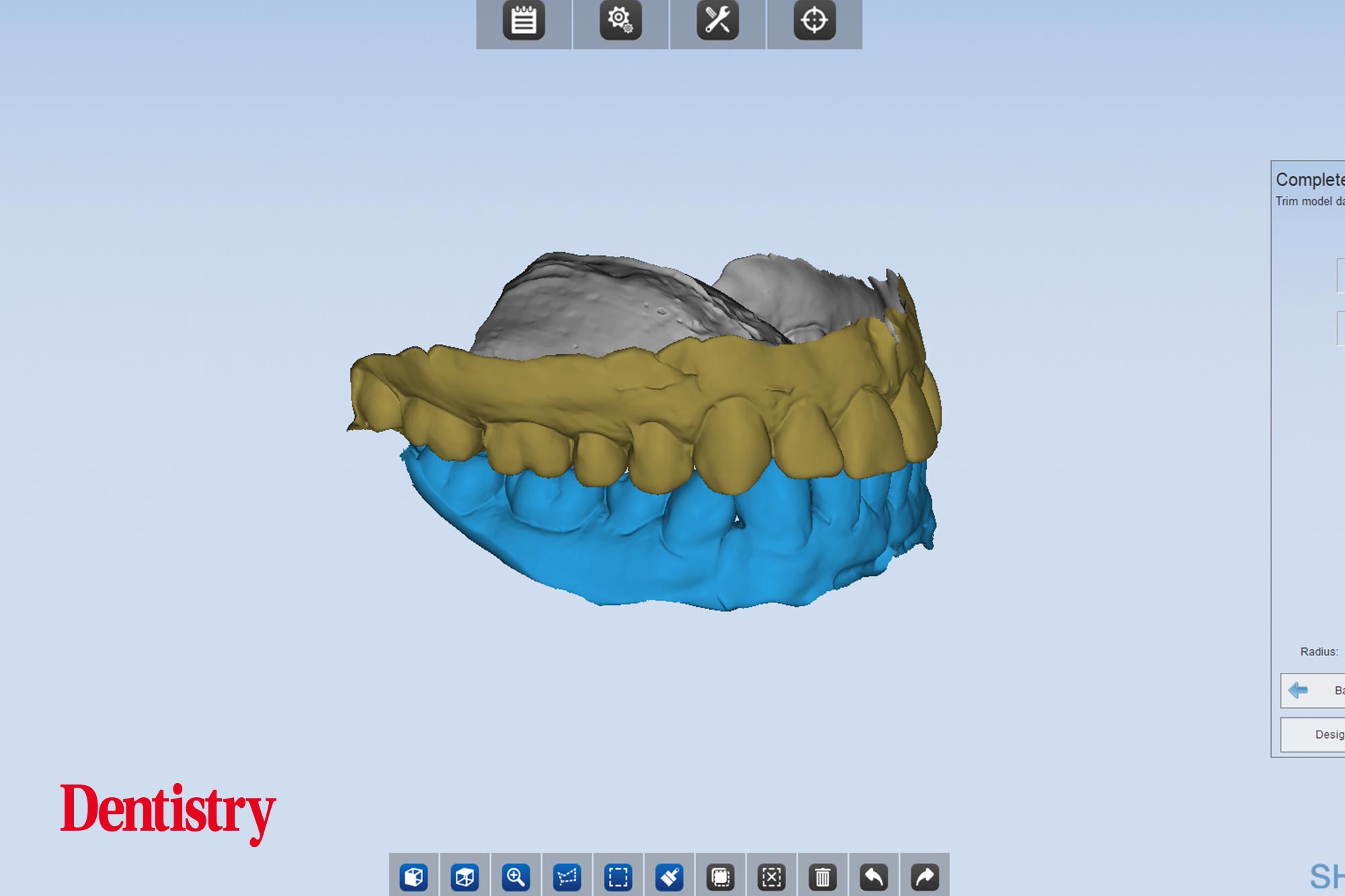 Andre Gaul RDT gives a step-by-step overview of the design and fabrication process of printed occlusal splints.