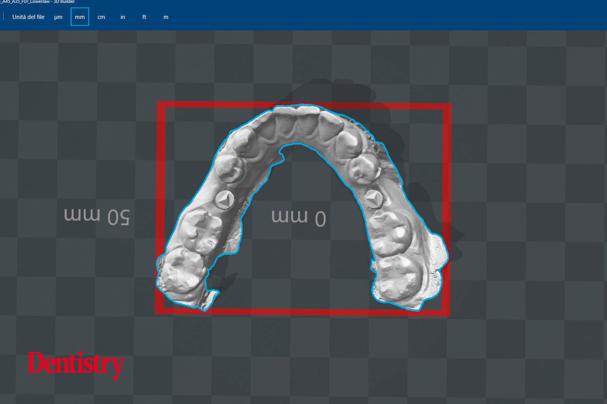 Mauro Fazioni and Andrea Lombardo discuss the importance of making implants with toothlike restoration materials and how you can do this.