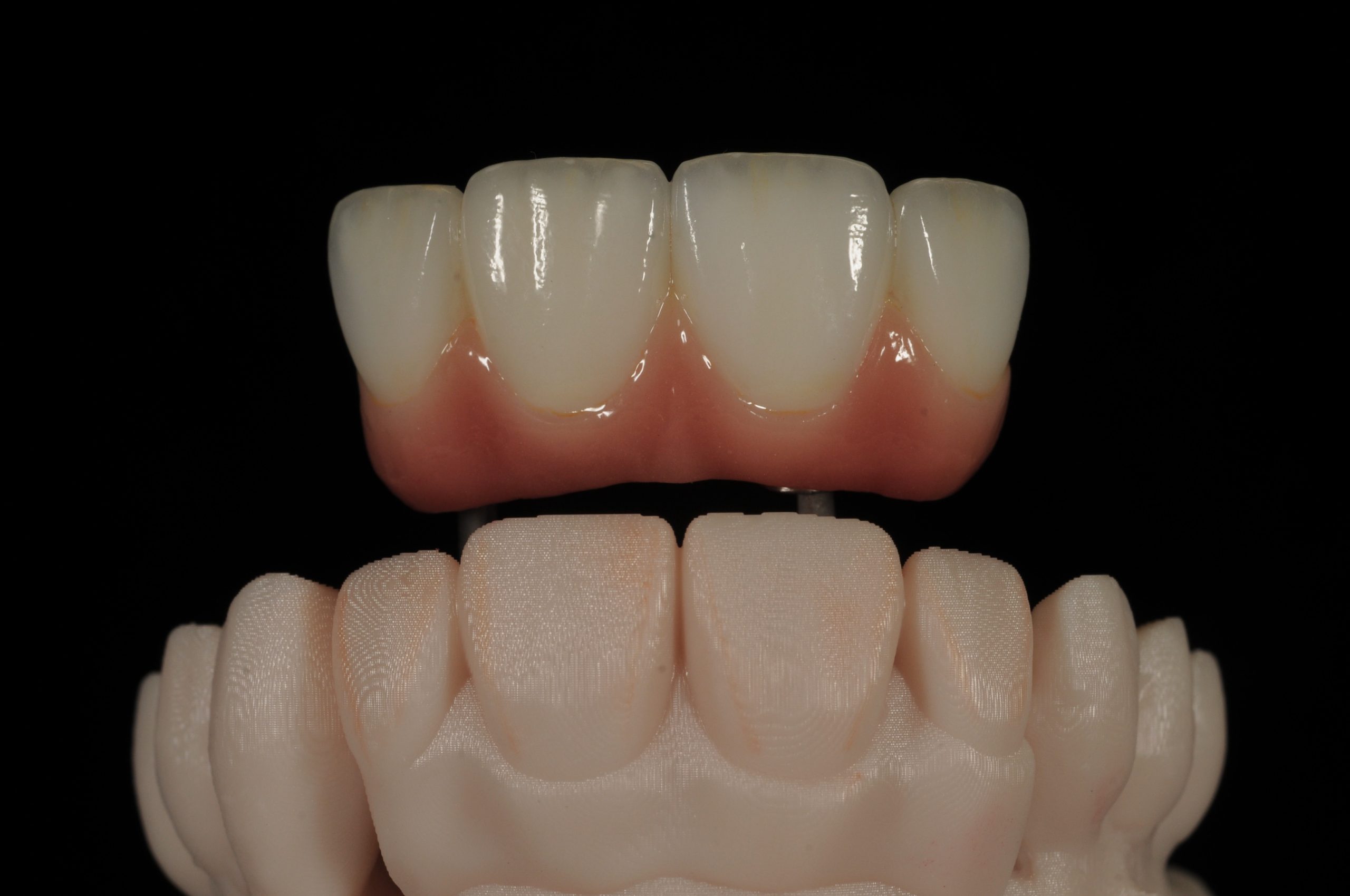 Carving a new era: Ashley Byrne explains why he is never looking back after adopting digital diagnostic set-ups.