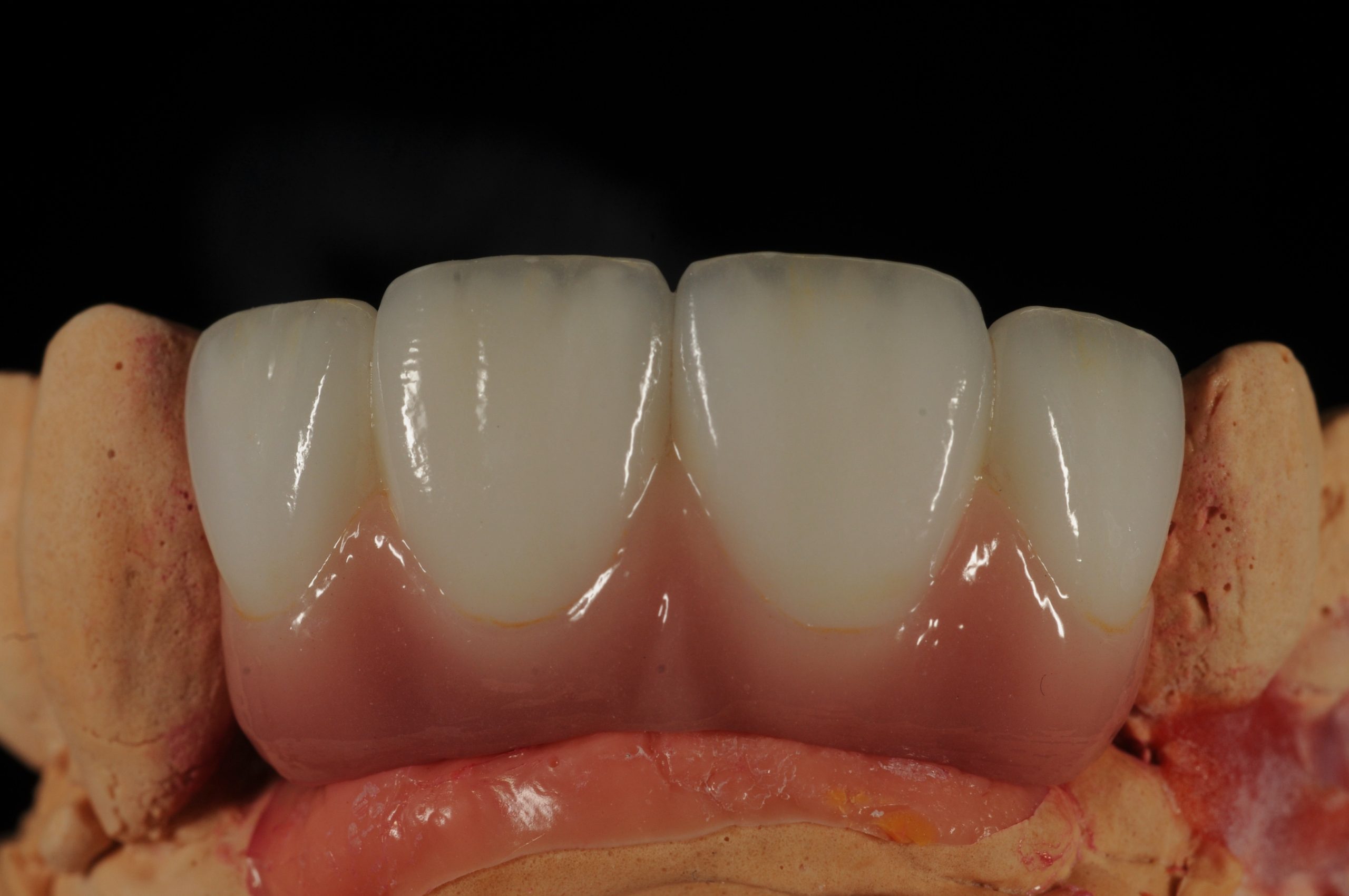 Carving a new era: Ashley Byrne explains why he is never looking back after adopting digital diagnostic set-ups.
