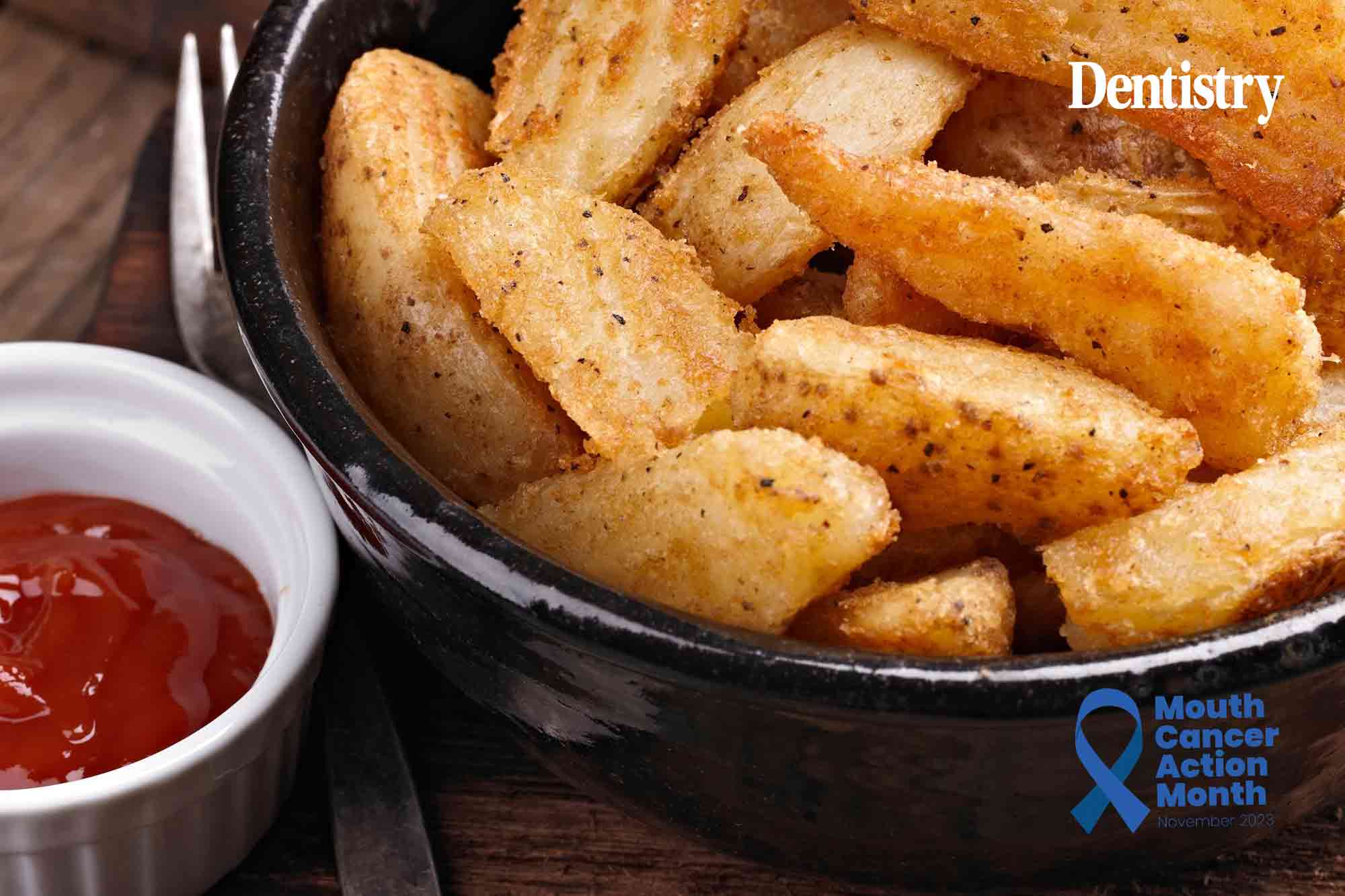 Eating more ultra-processed foods linked to higher risk of mouth cancers