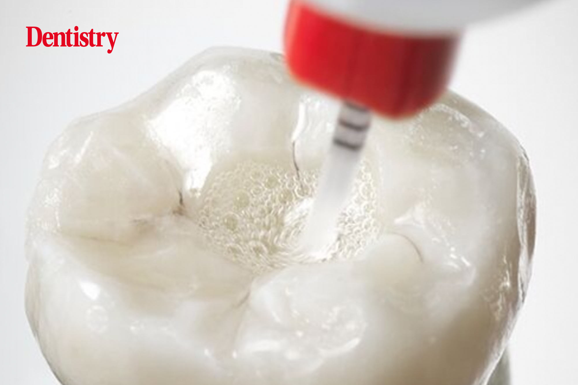 What makes the new SmartLite Pro EndoActivator from Dentsply Sirona the solution for faster and more effective root canal irrigation?