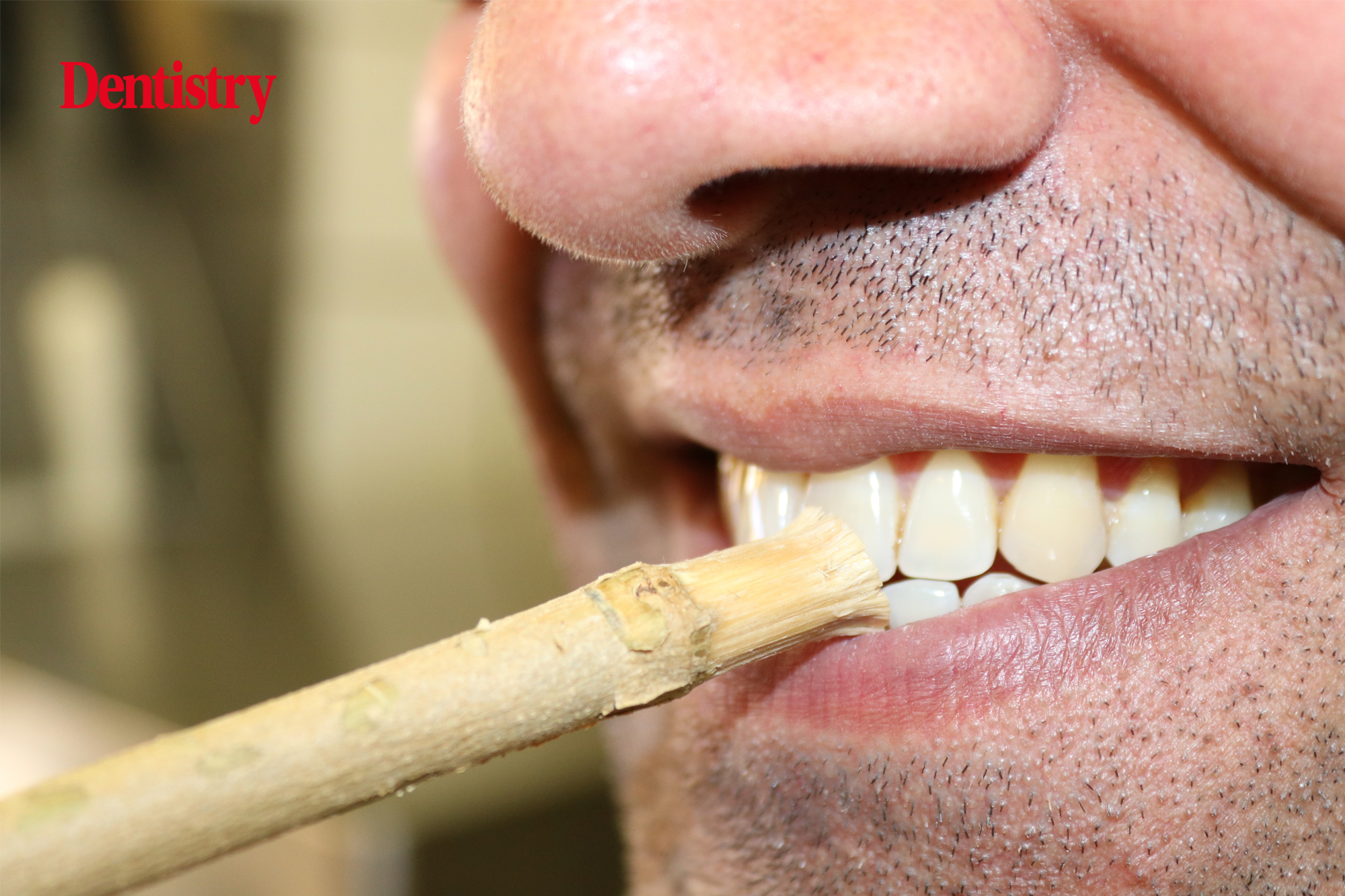 impact of culture on oral health