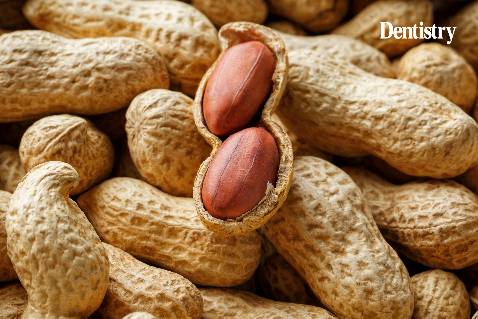 peanut toothpaste could reduce allergy severity 