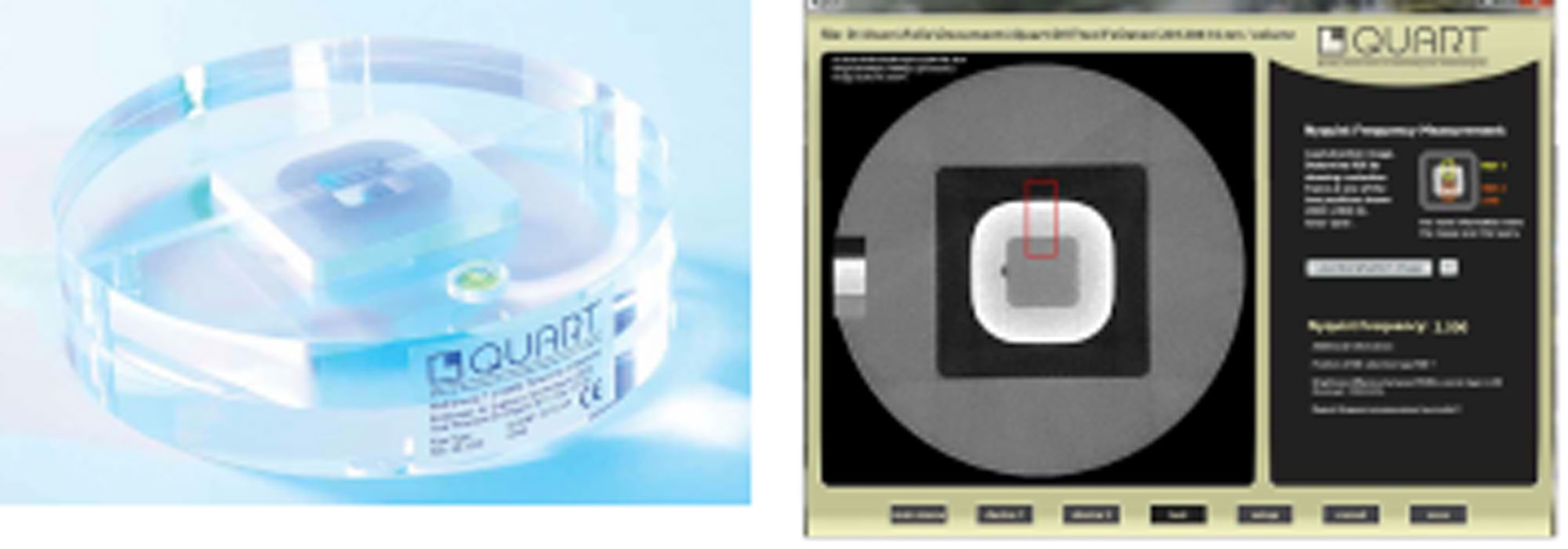 cbct