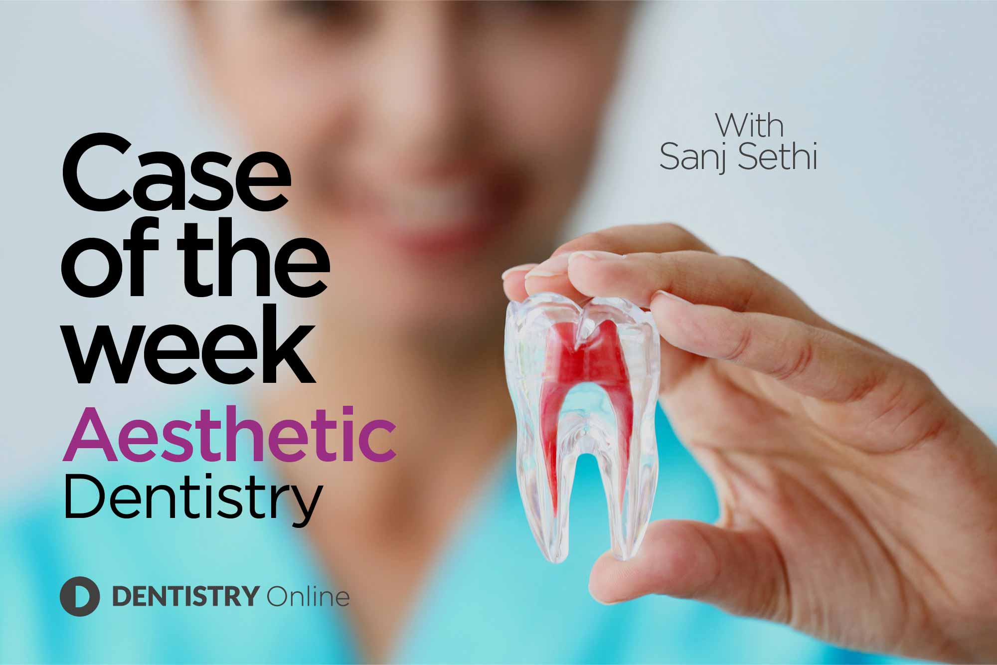 composite bonding clinical case