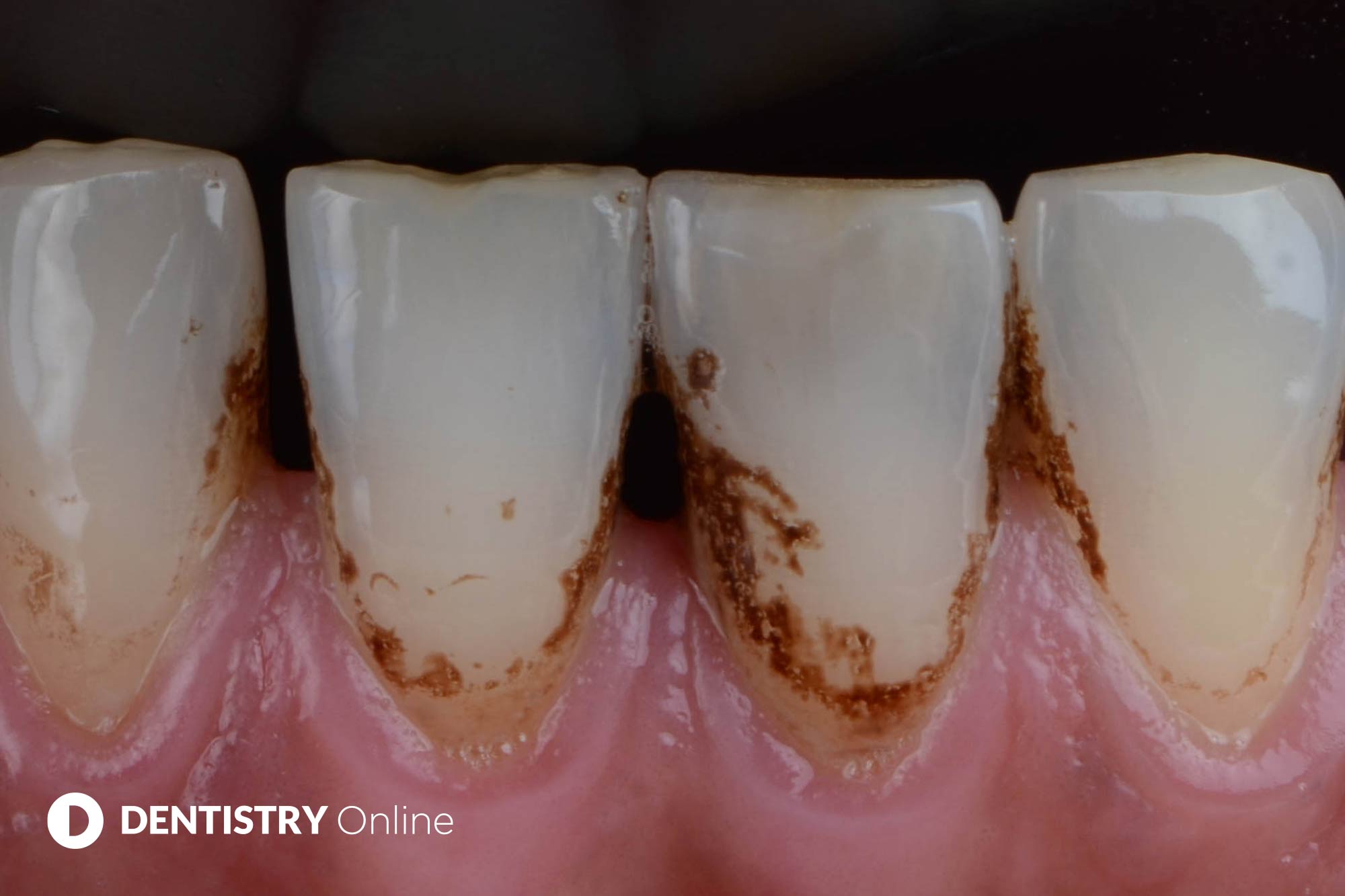 patient case study 