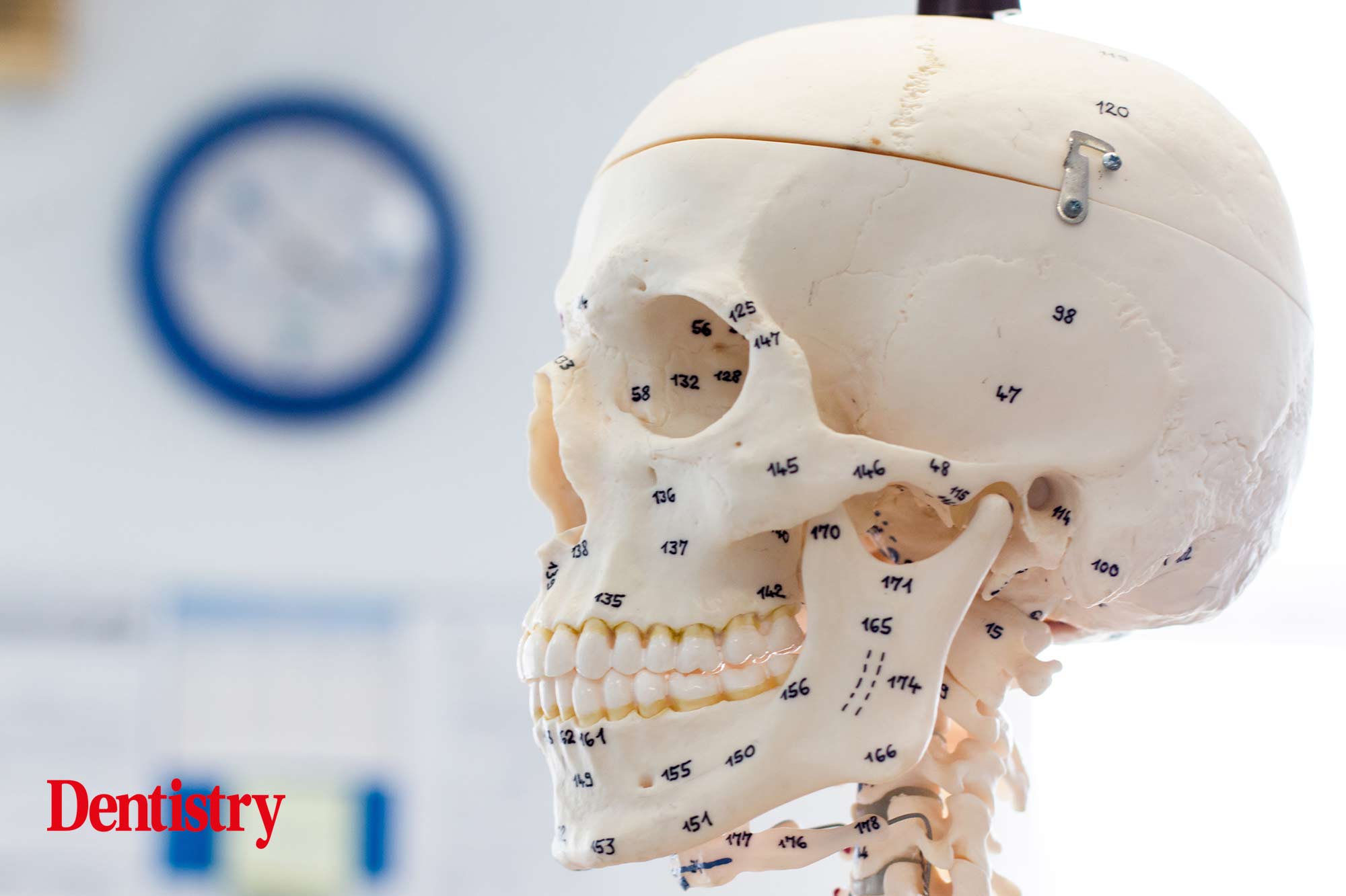 zygomatic