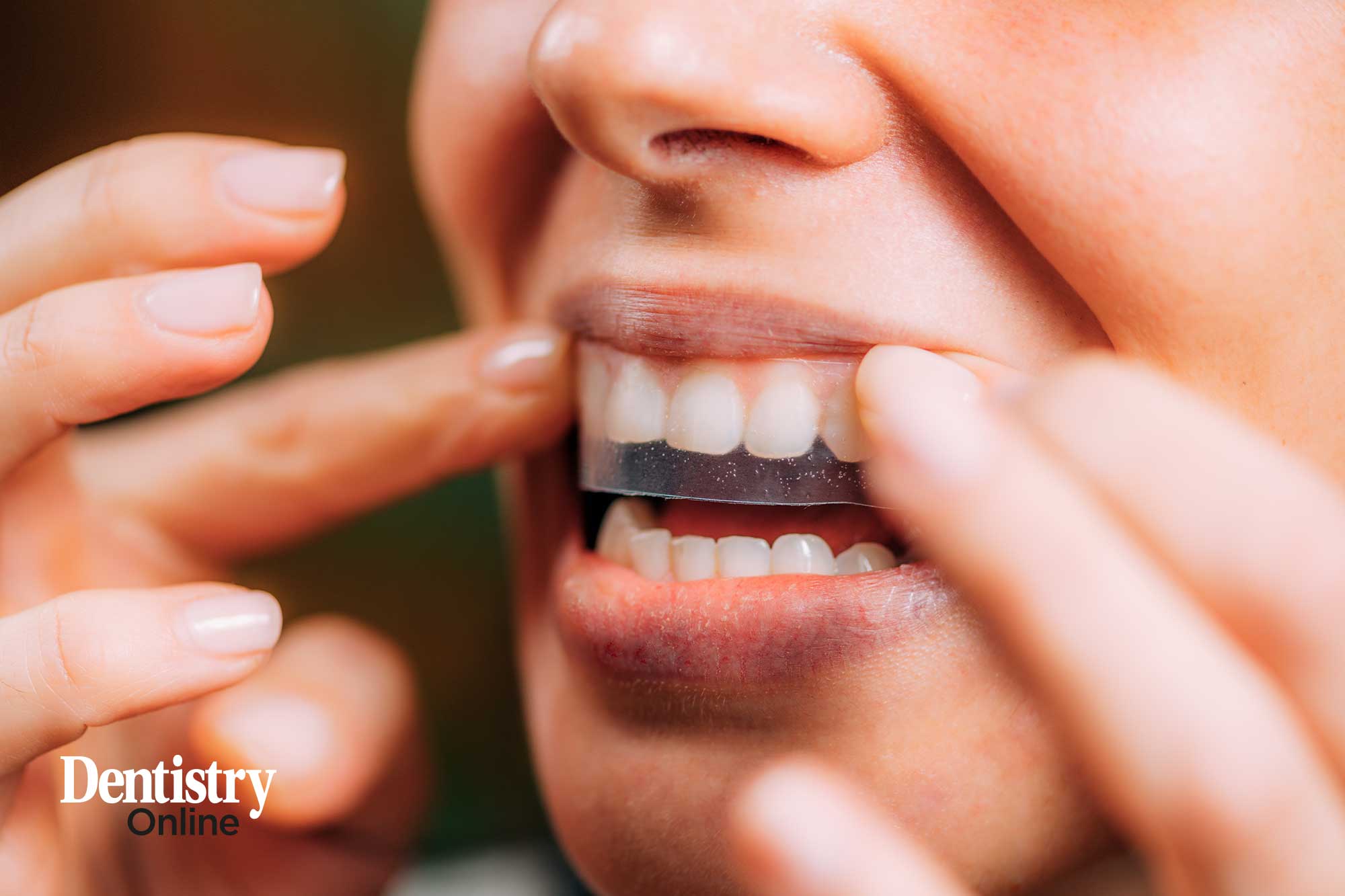 illegal tooth whitening