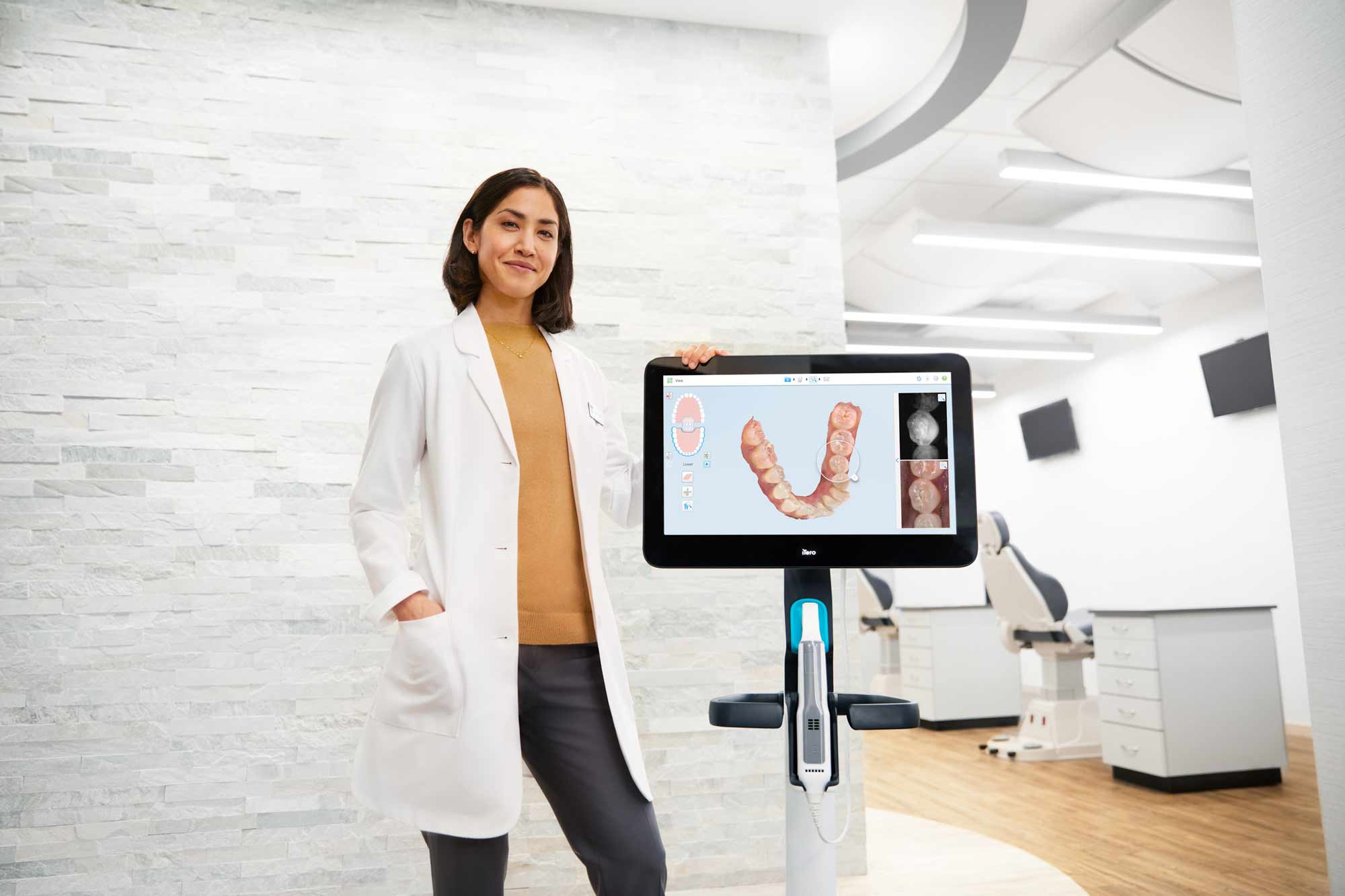 itero element scanner