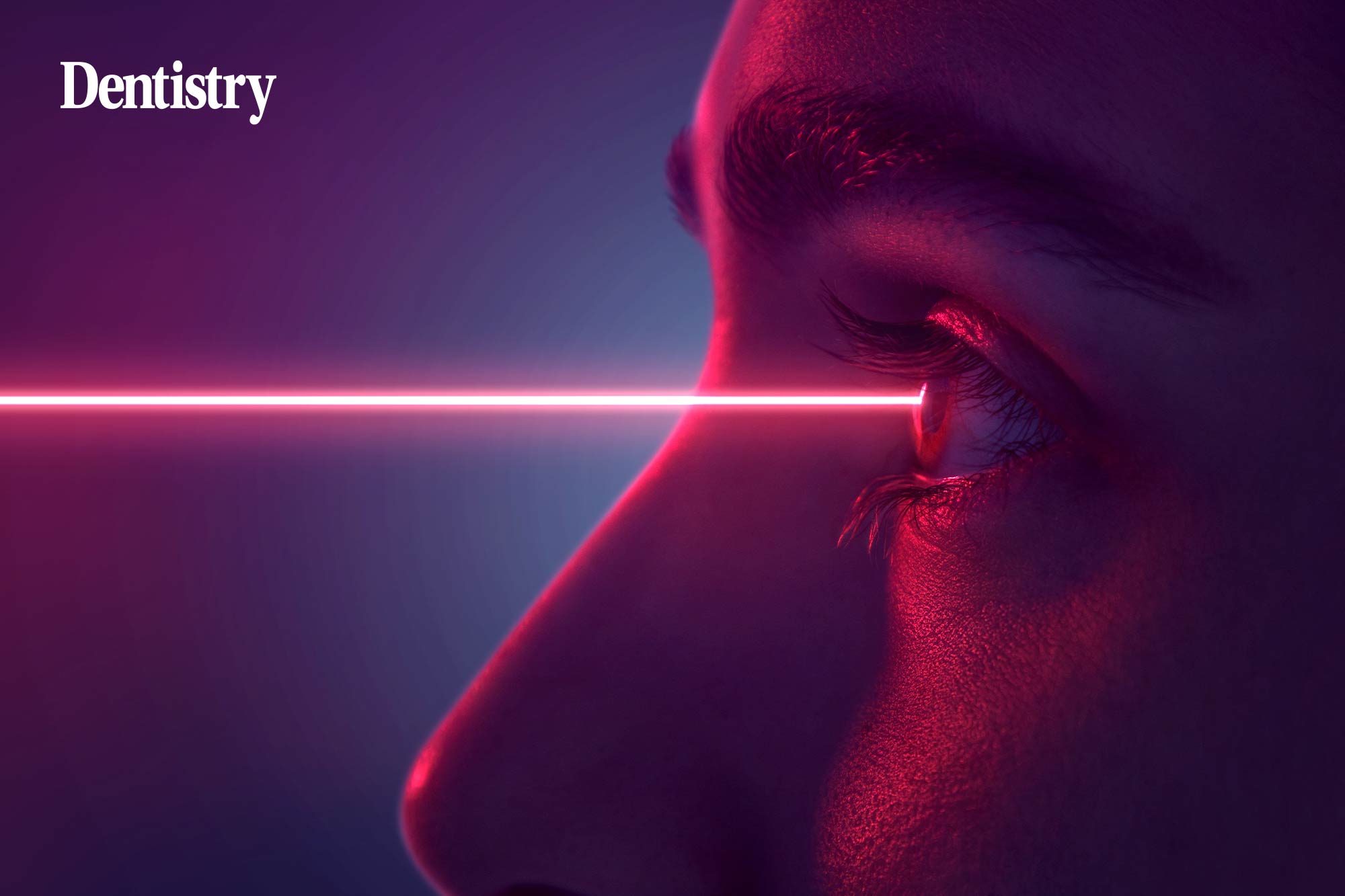laser