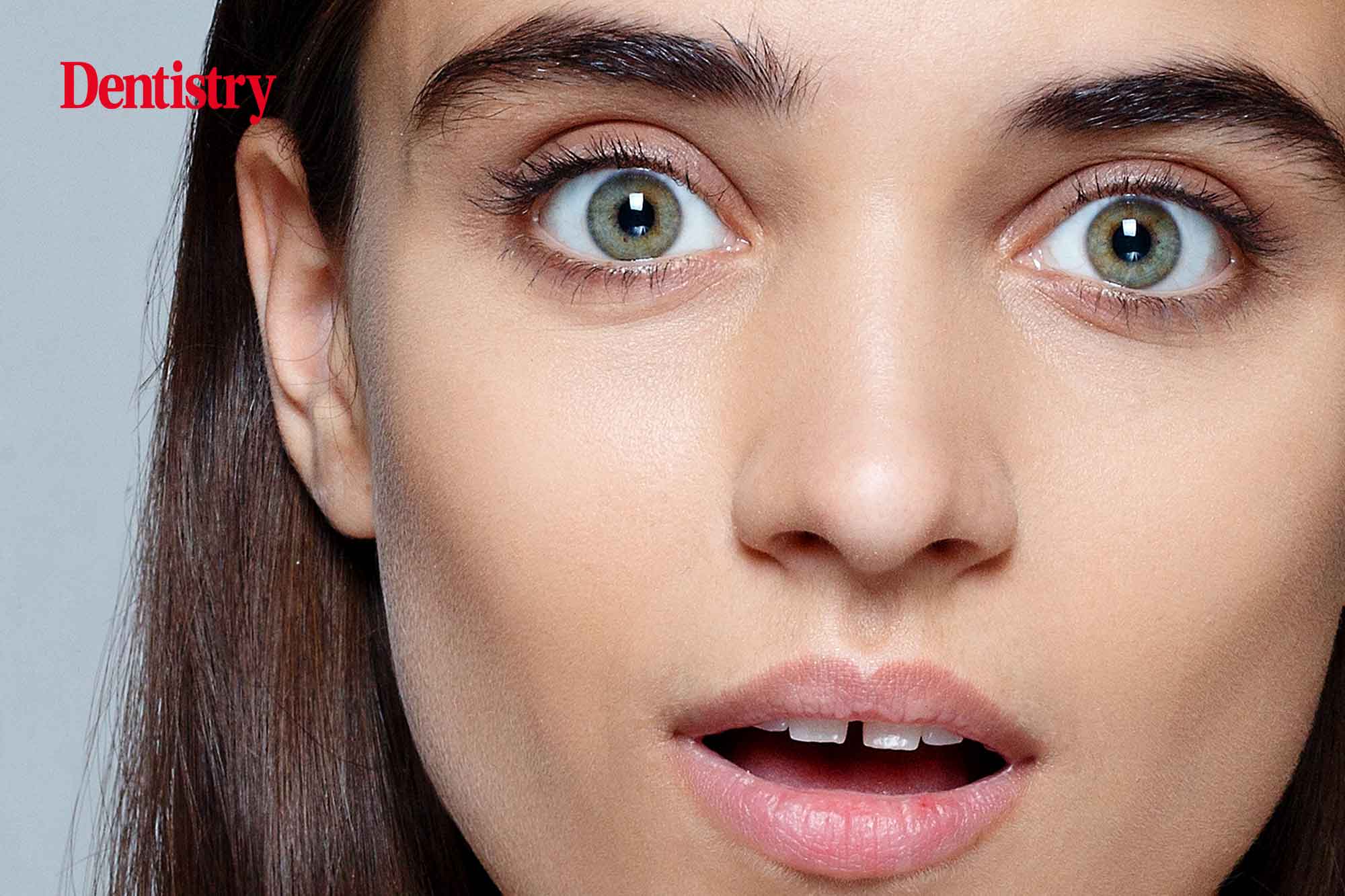 anodontia treatment