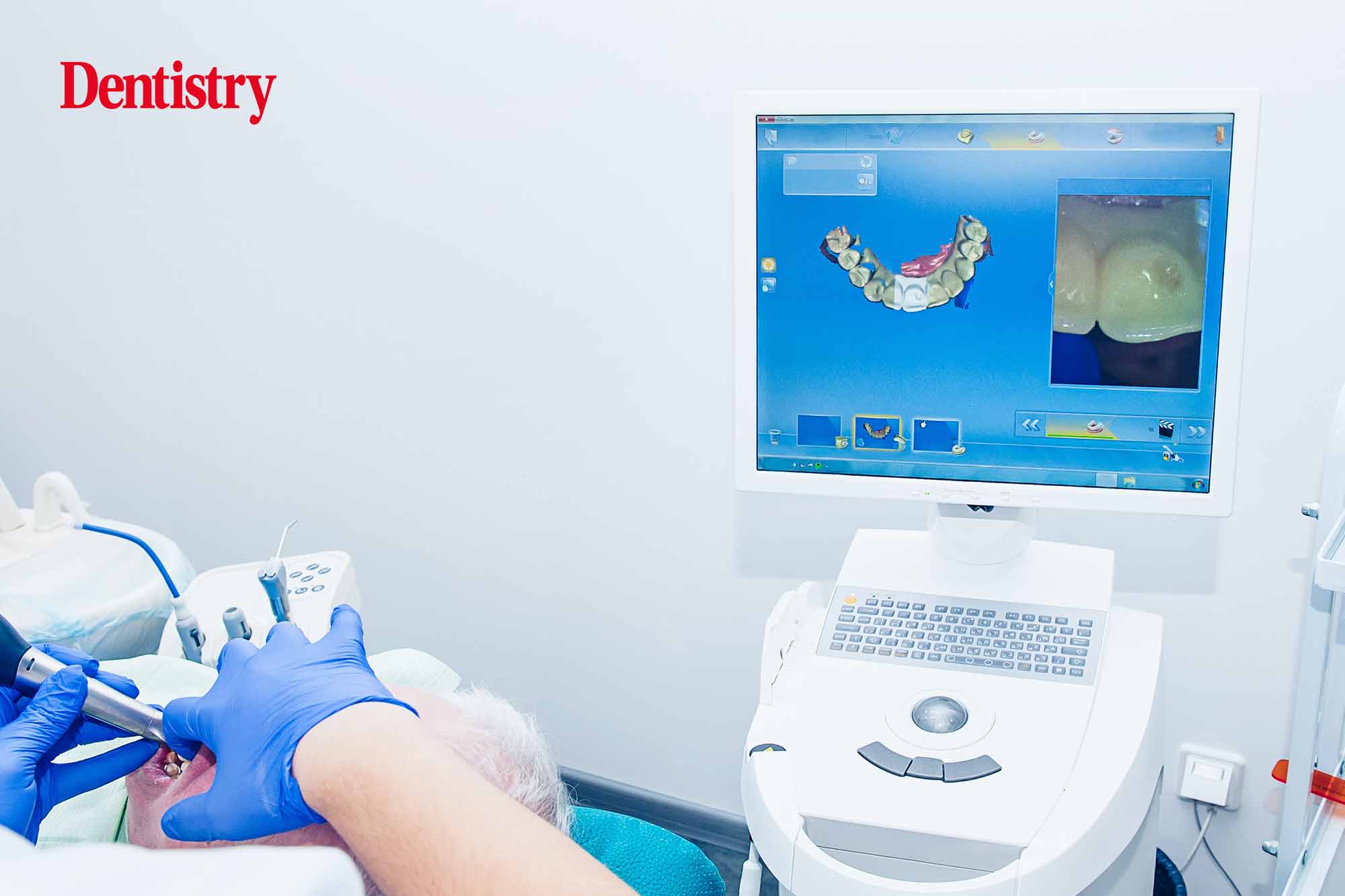 digital dentures