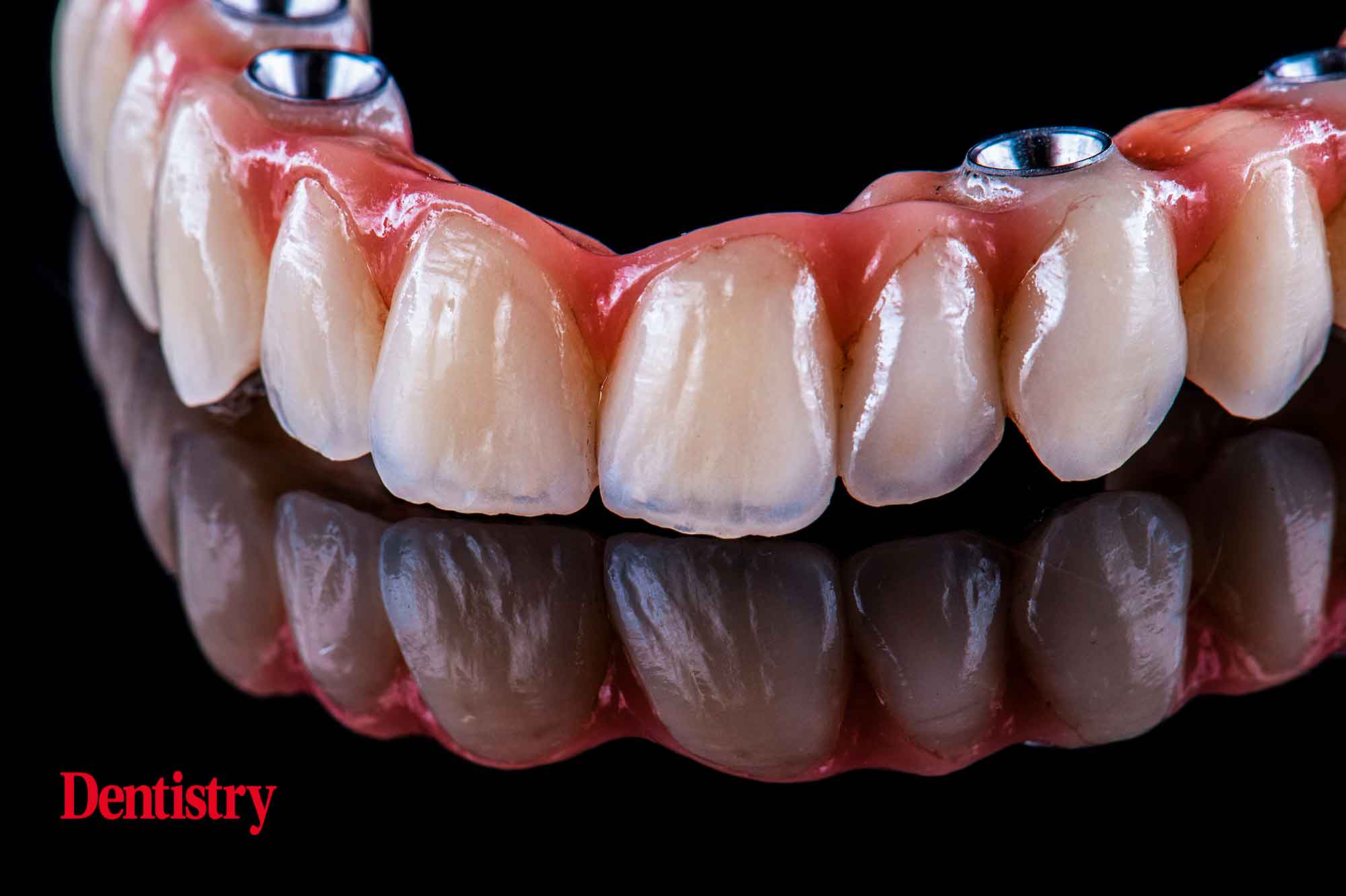 implant