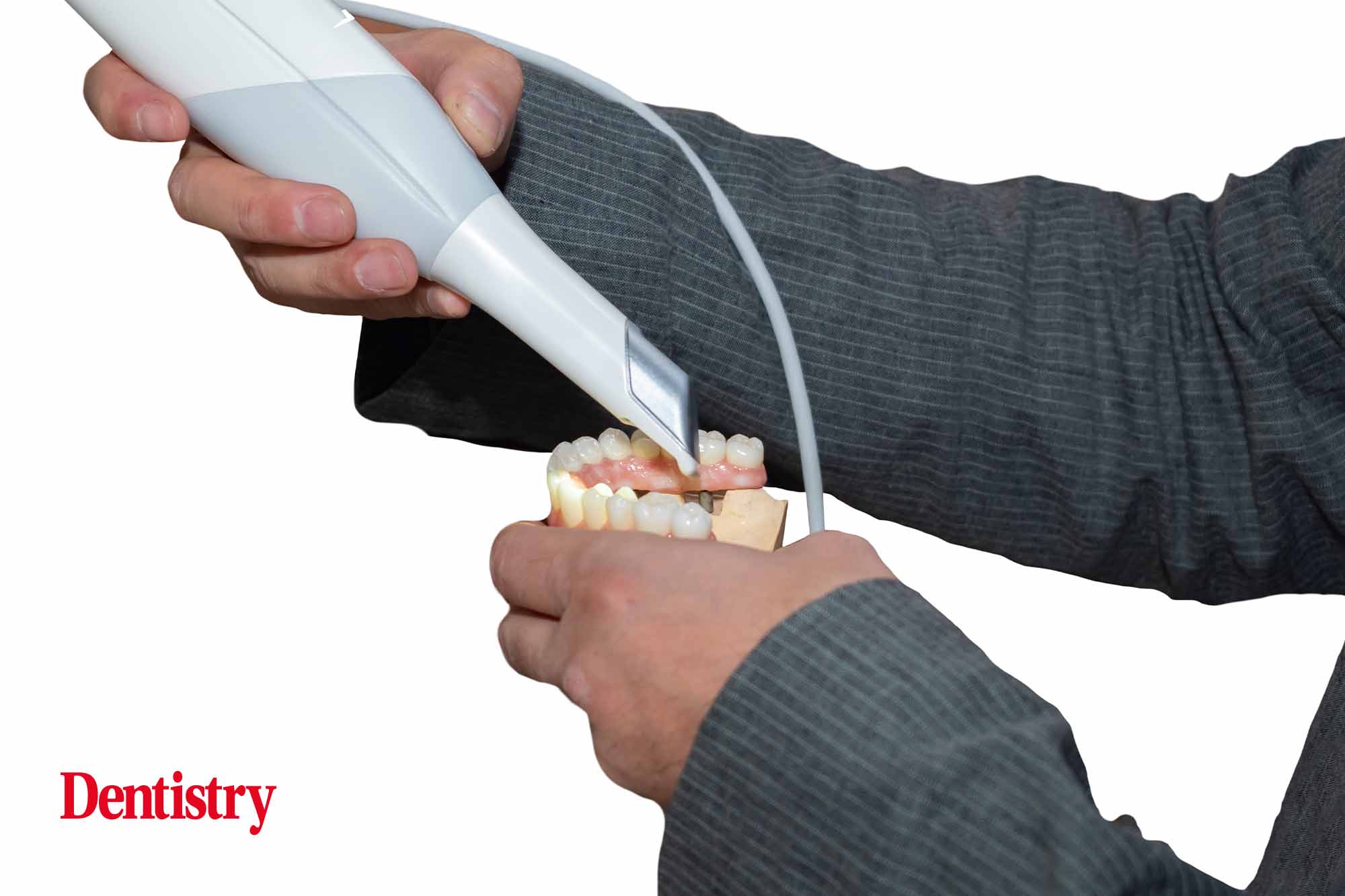 intraoral scanner