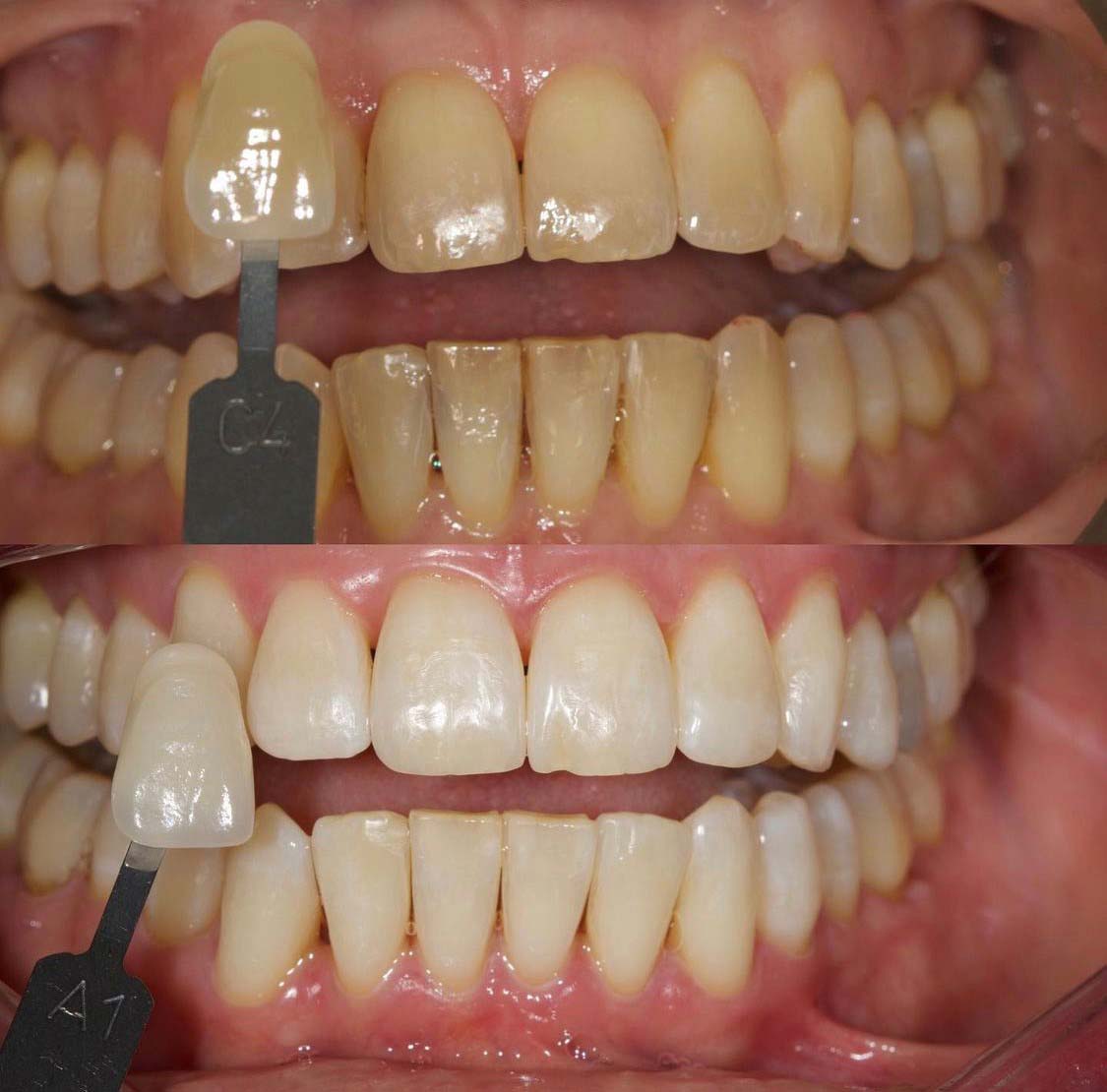 Biomin whitening