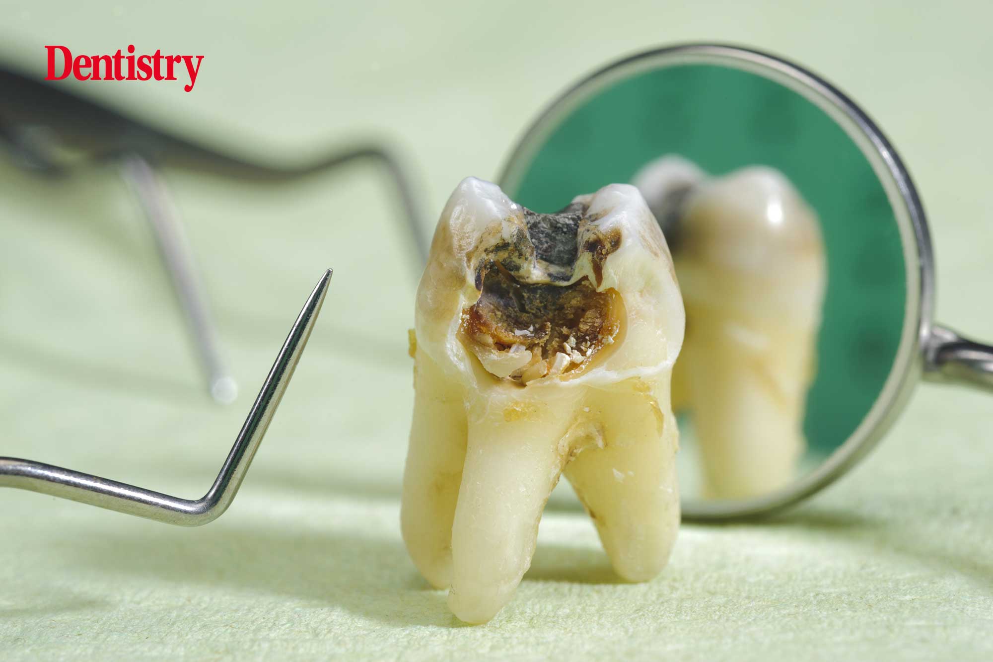 extracting the wrong tooth