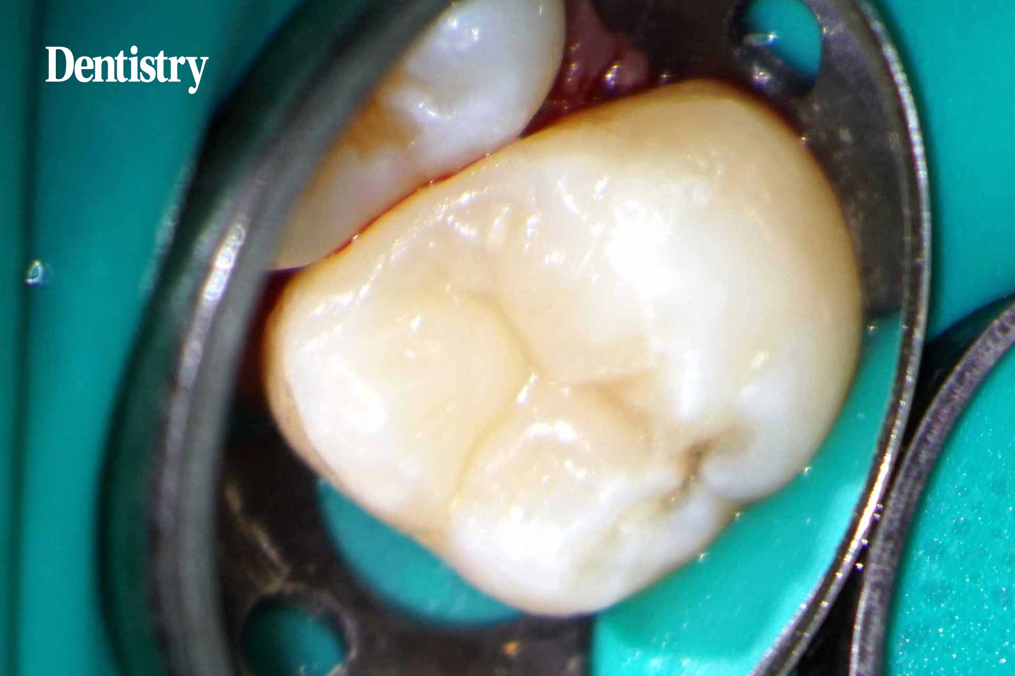 endodontics