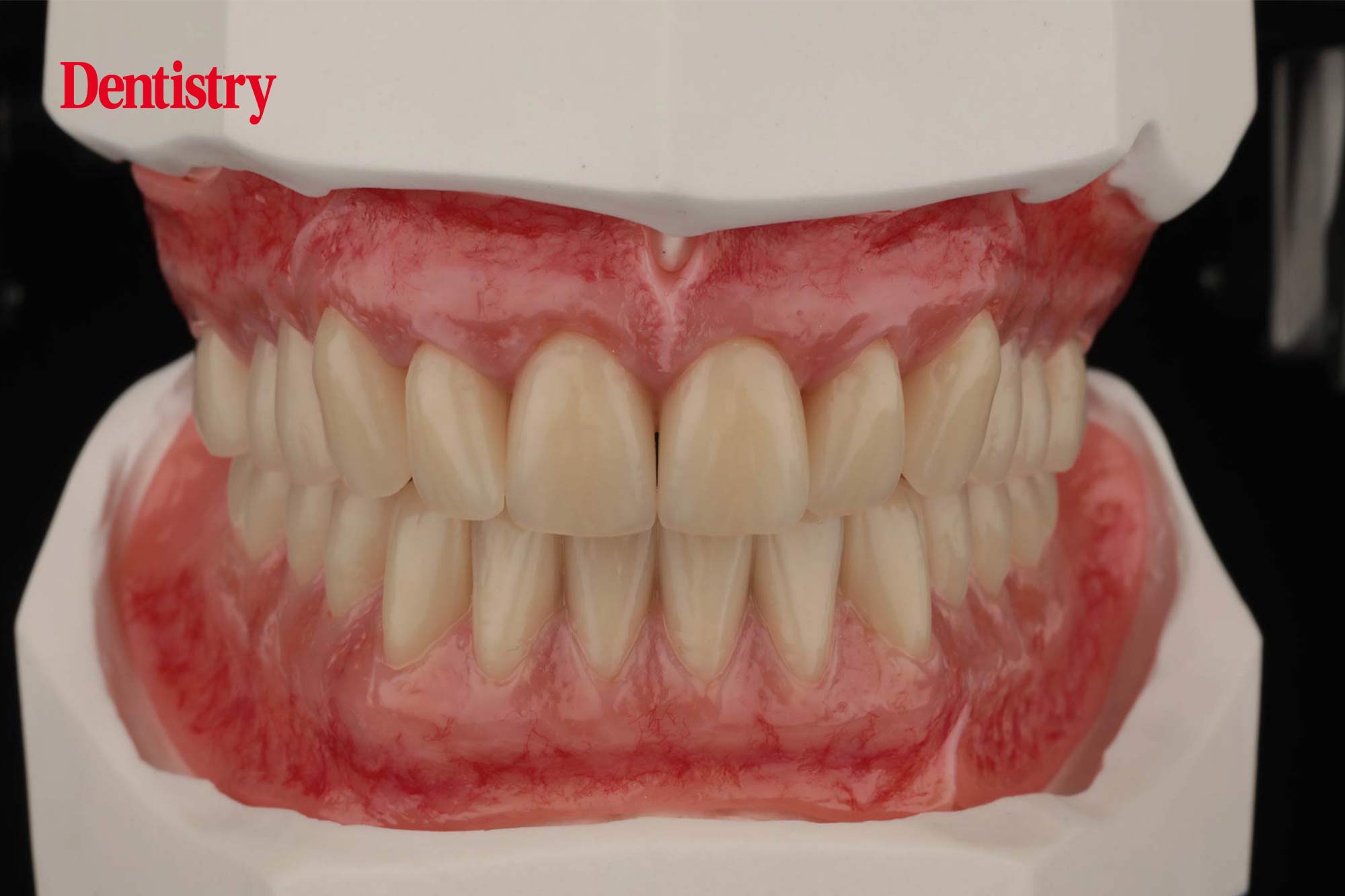 implant technology ivoclar