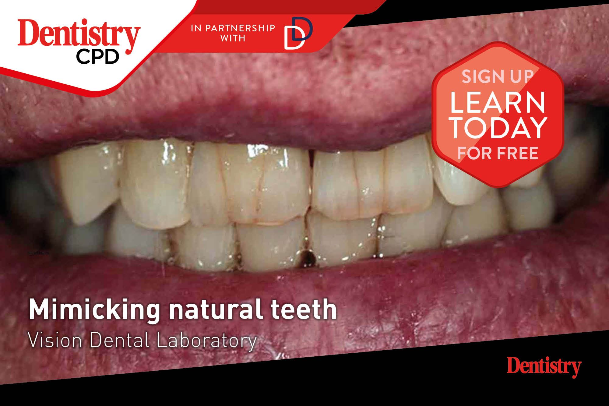 Dentistry CPD: new this week – mimicking natural teeth