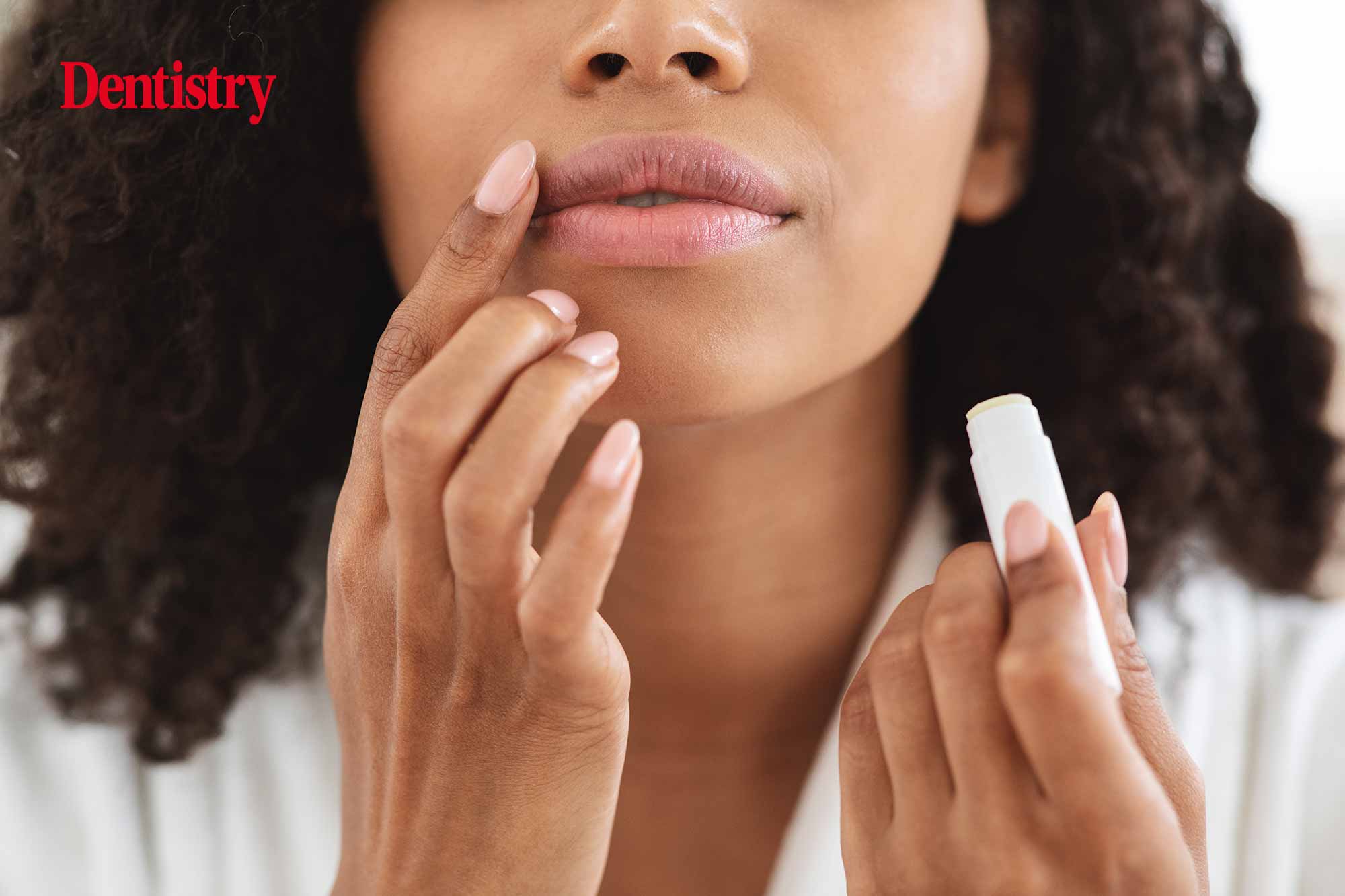 lip balm to avoid lip cancer
