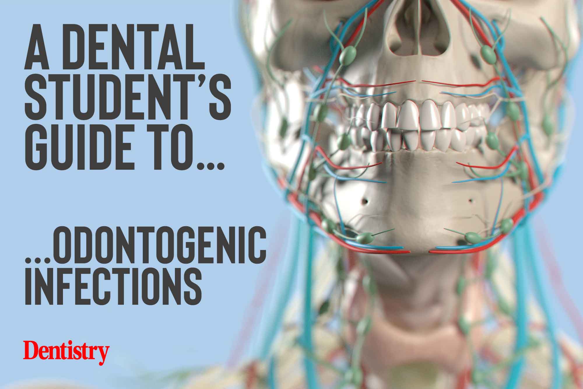 odontogenic infections