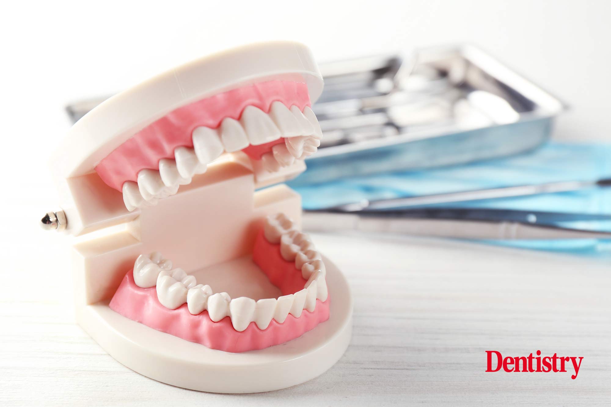veneers