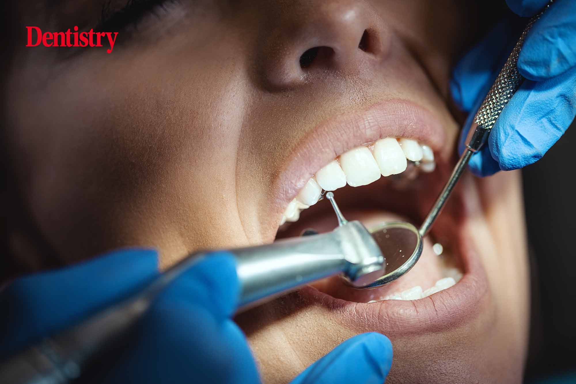 More than 70 dentists move away from NHS work in Leceister