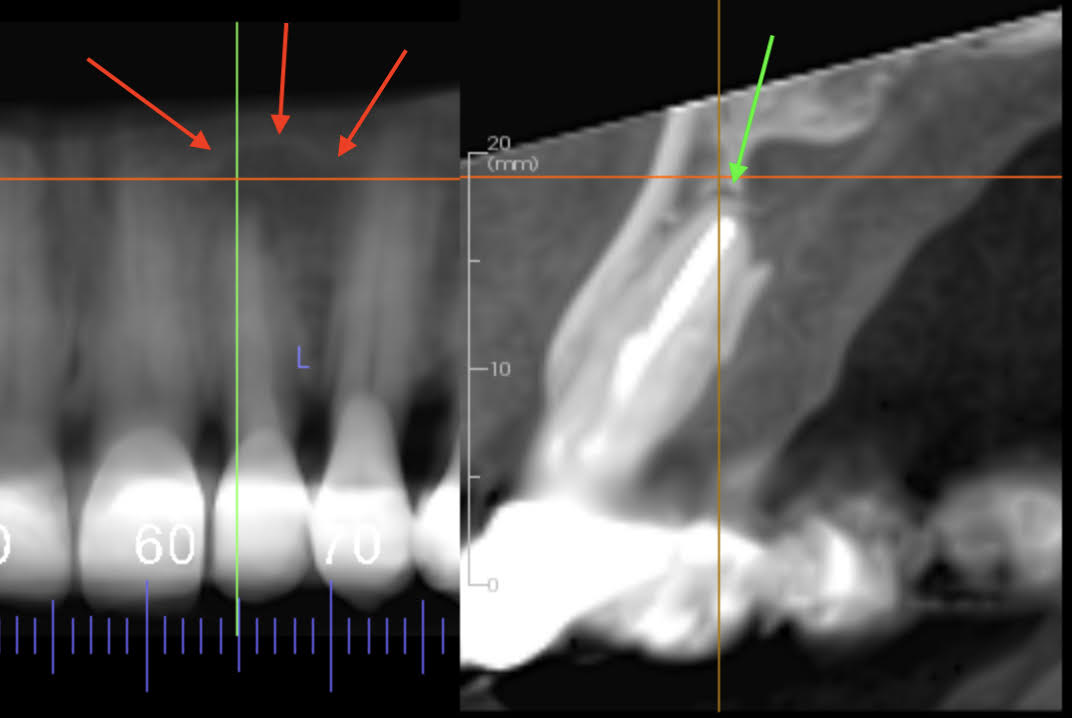 CBCT 1