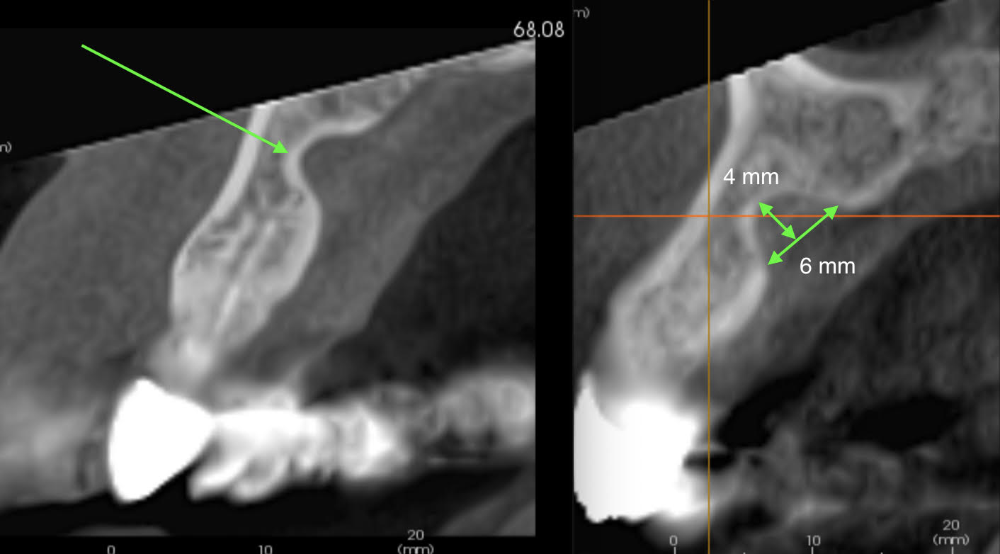 CBCT 2