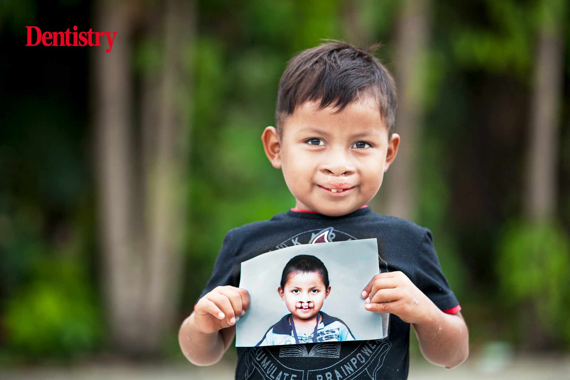 operation smile