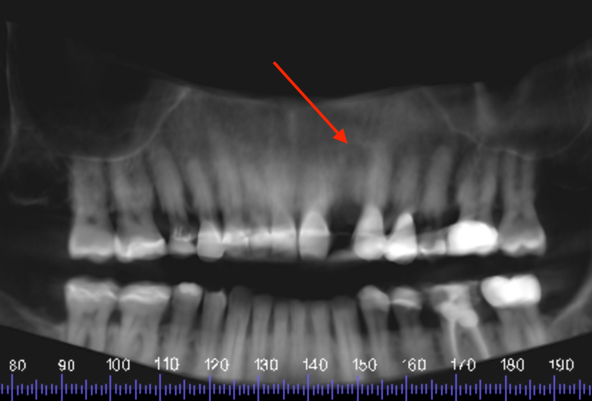 CBCT 3