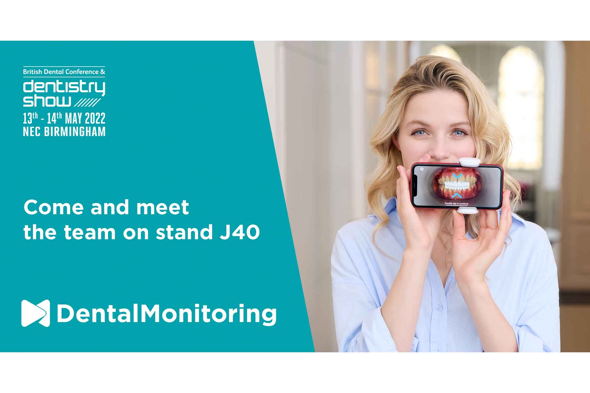 dental monitoring