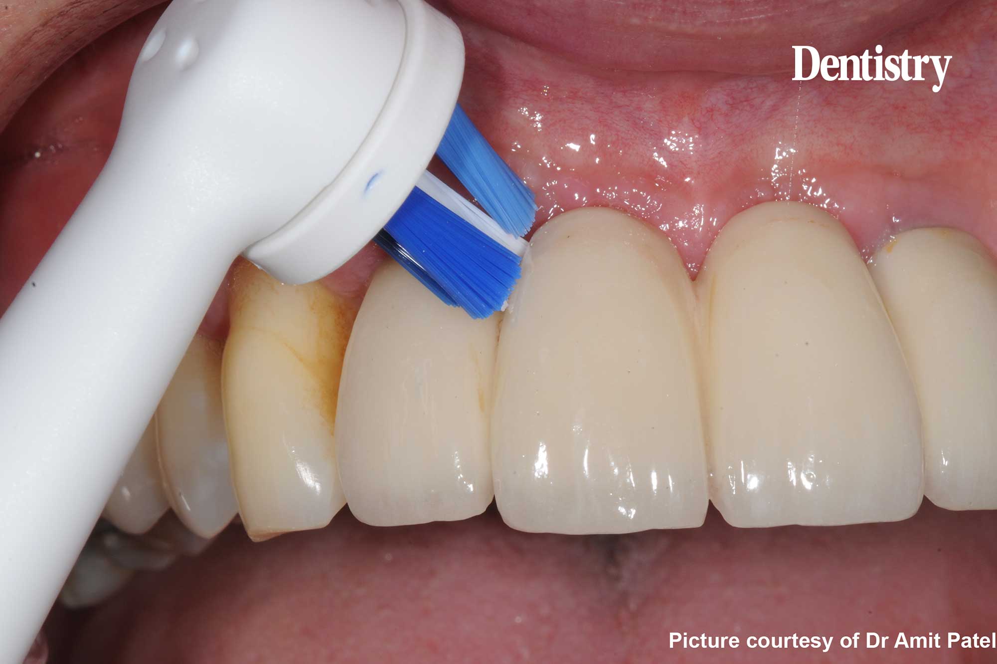 specialised clean toothbrush head