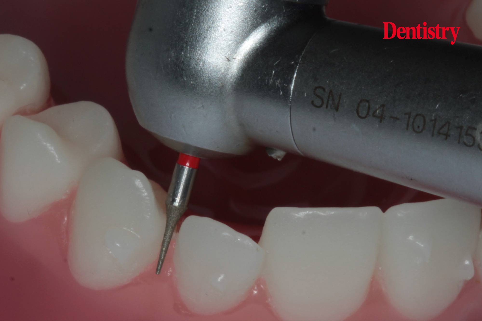 Tim Witcher discusses how to carry out IPR in a stress-free and safe way.