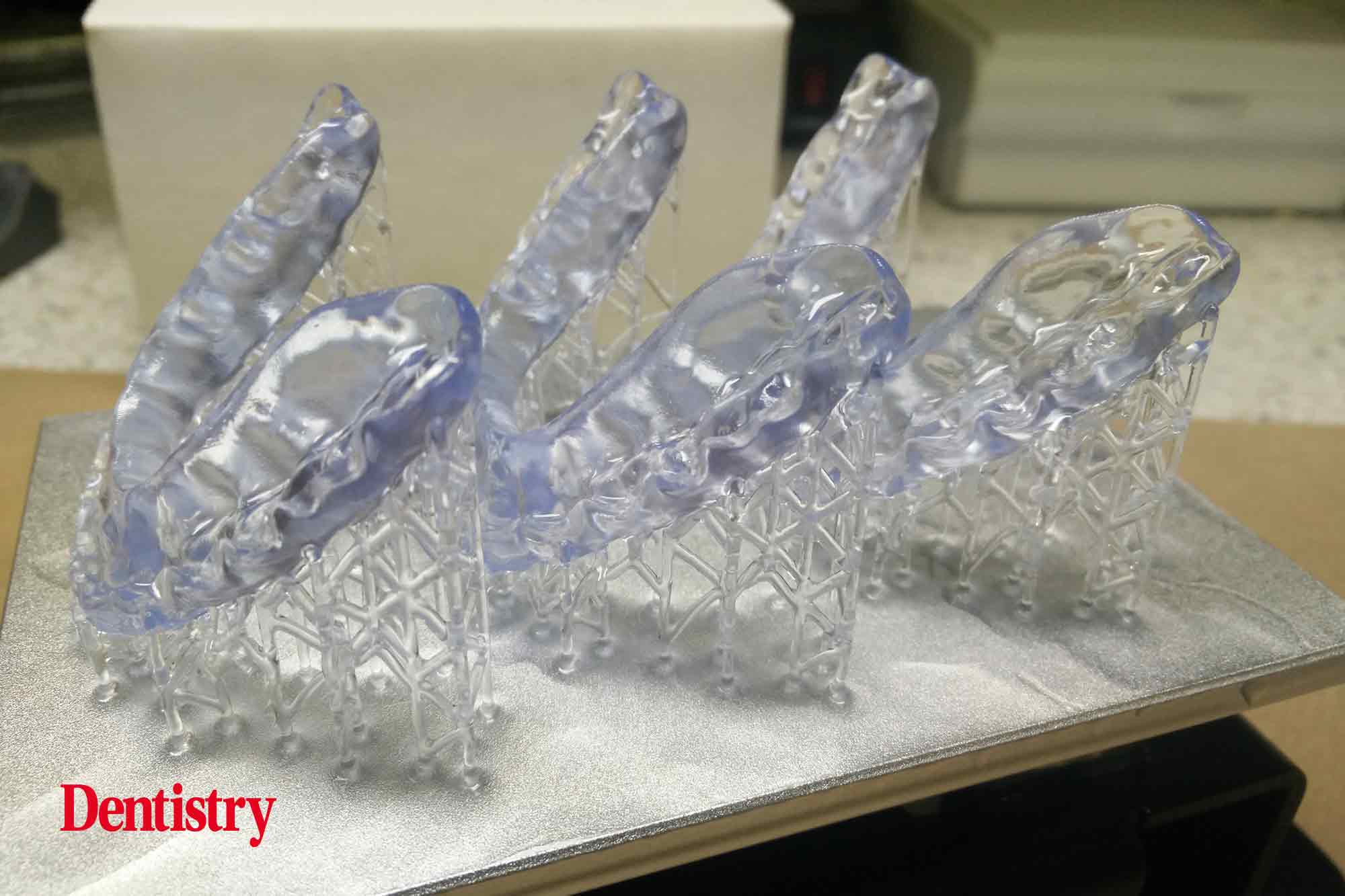 Andre Gaul RDT gives a step-by-step overview of the design and fabrication process of printed occlusal splints.