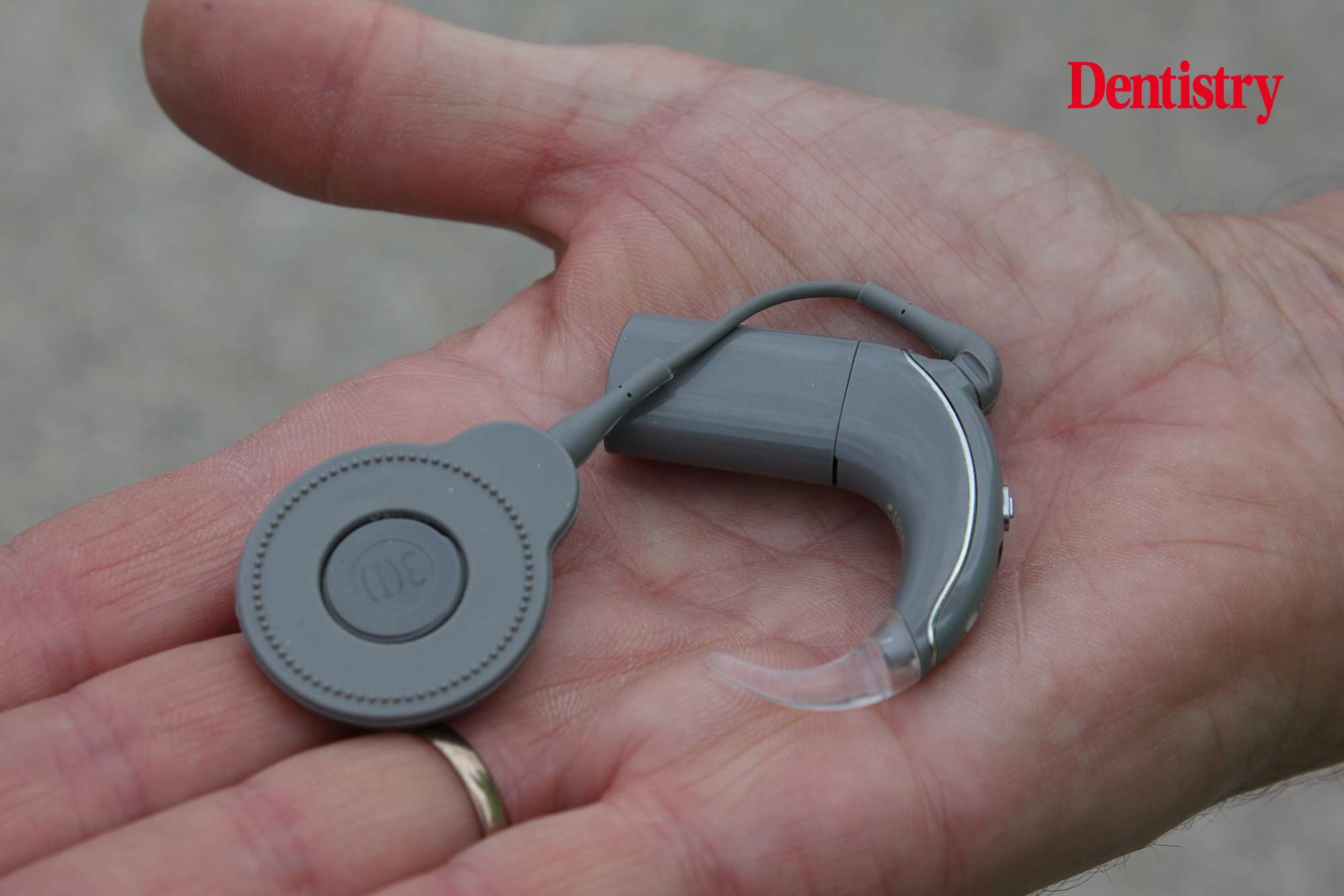 Disability Pride Month – how a cochlear implant changed my life in dentistry