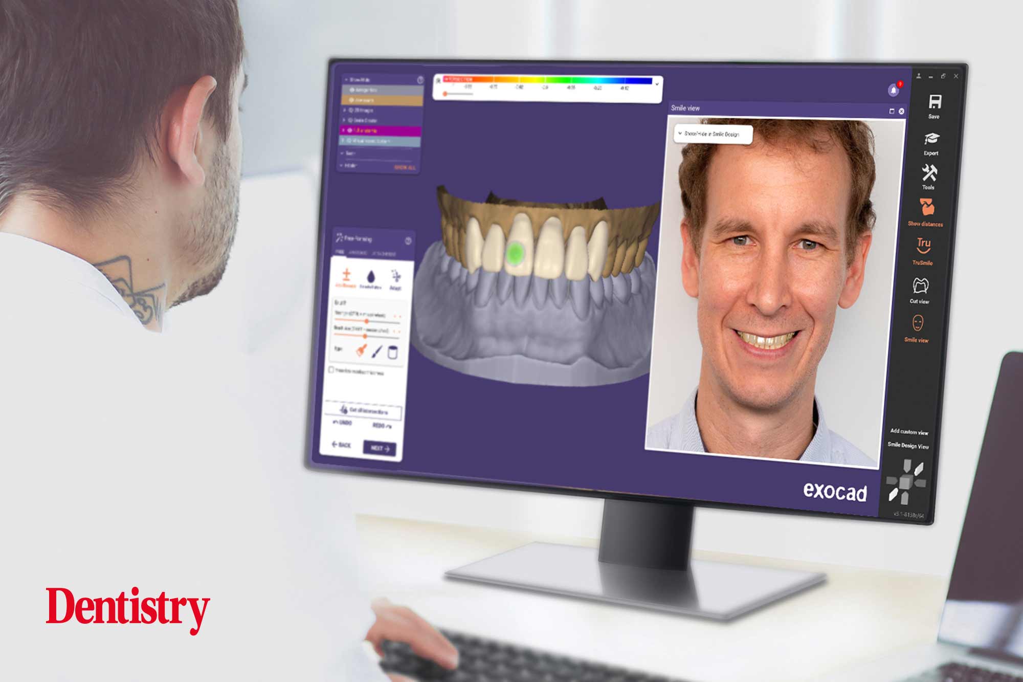 Exocad introduces Dentalcad 3.1 Rijeka software